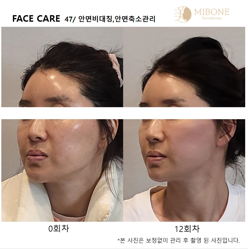 미본 얼굴윤곽관리 신촌점 대표 이미지