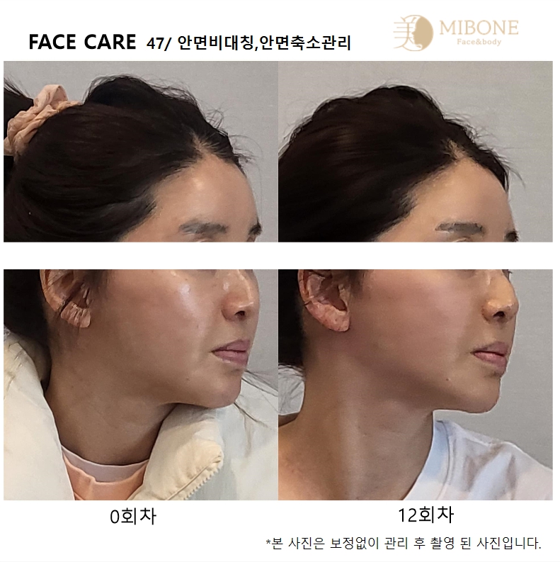 미본 얼굴윤곽관리 신촌점 대표 이미지