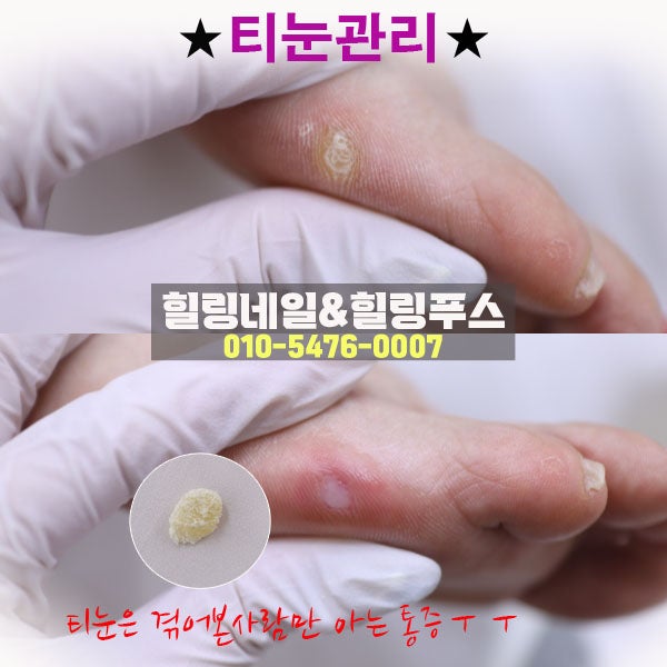 힐링네일&힐링푸스 대표 이미지