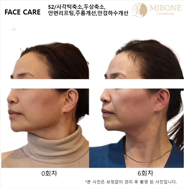 미본 신촌점 대표 이미지