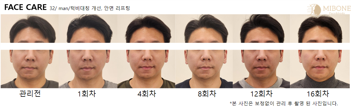 미본 얼굴윤곽관리 신촌점 대표 이미지