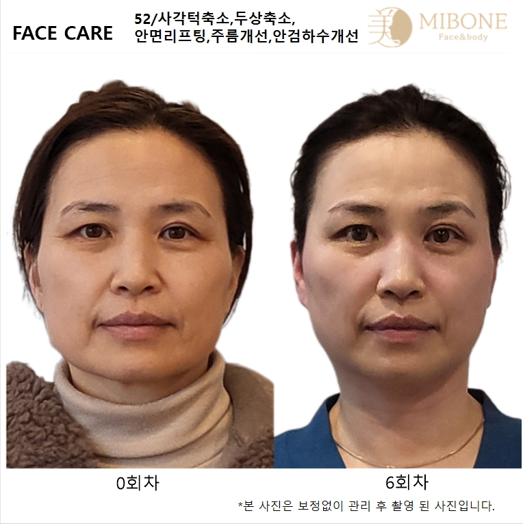 미본 신촌점 대표 이미지