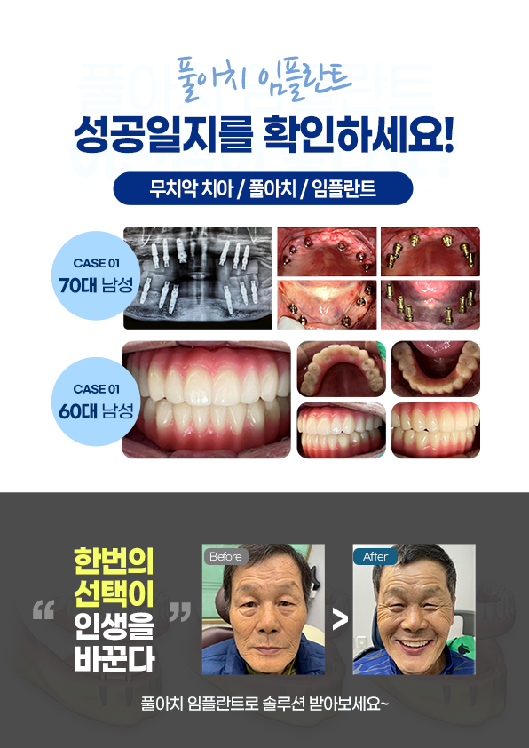 리드온치과의원 안양범계 대표 이미지