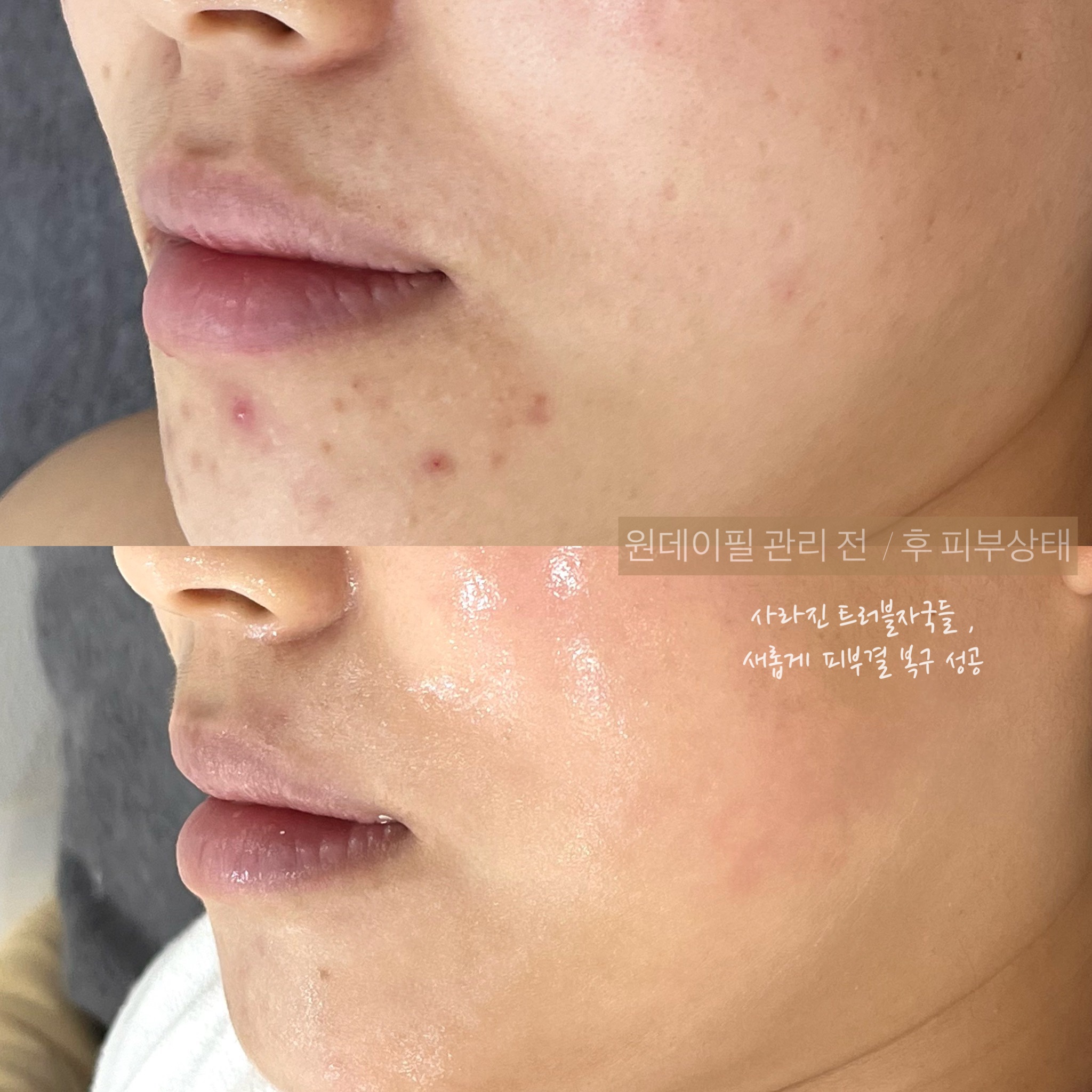 예뷰티 photo 2