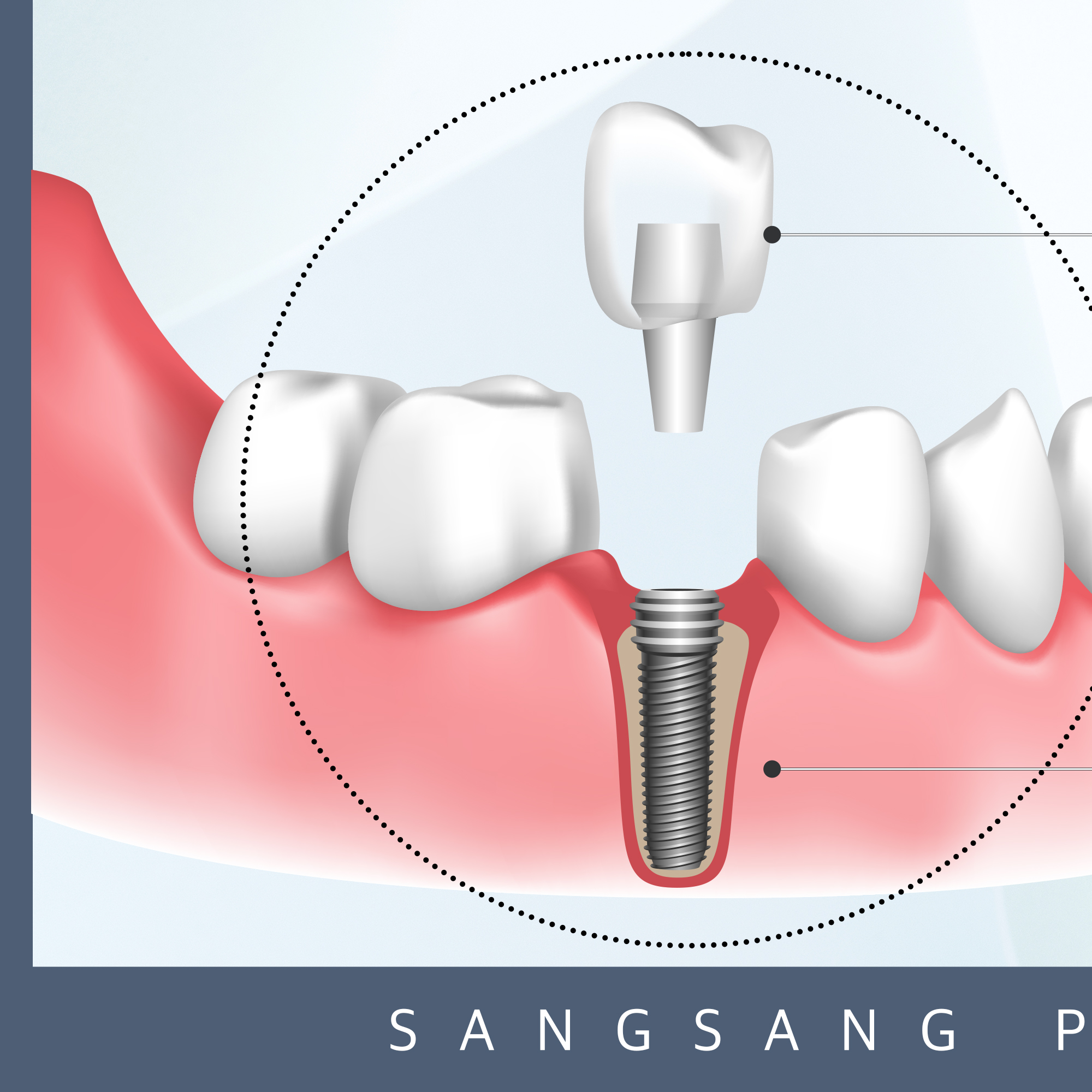 상상플란트치과의원 대표 이미지