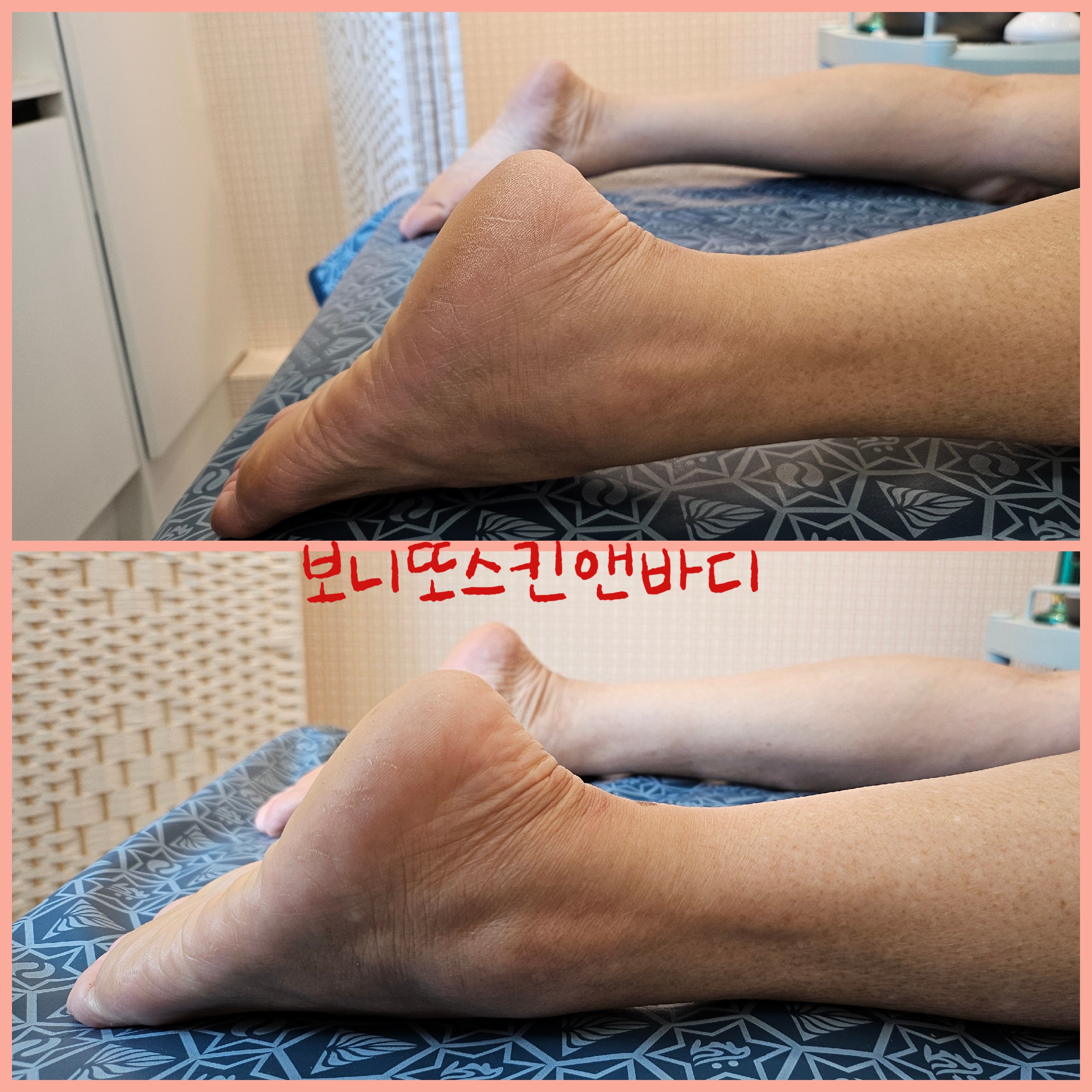 보니또 스킨앤바디