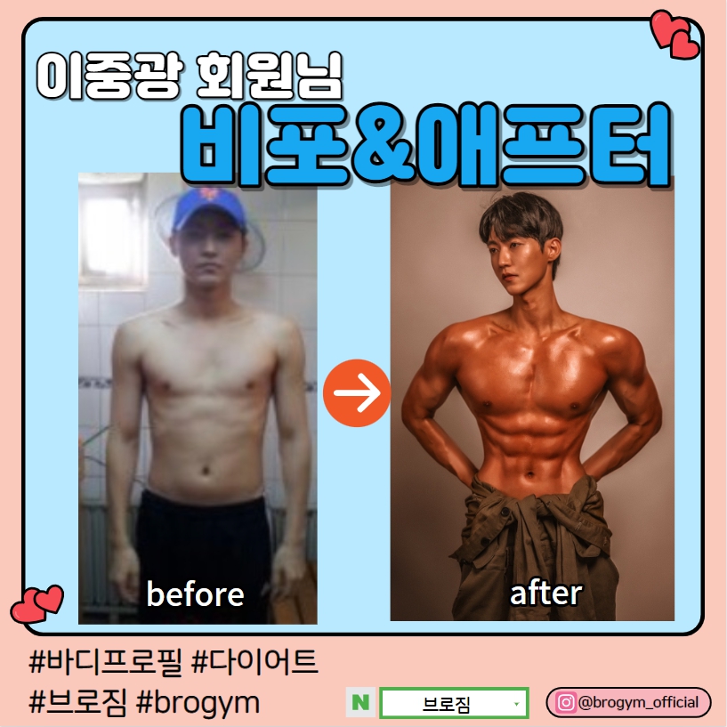 브로짐