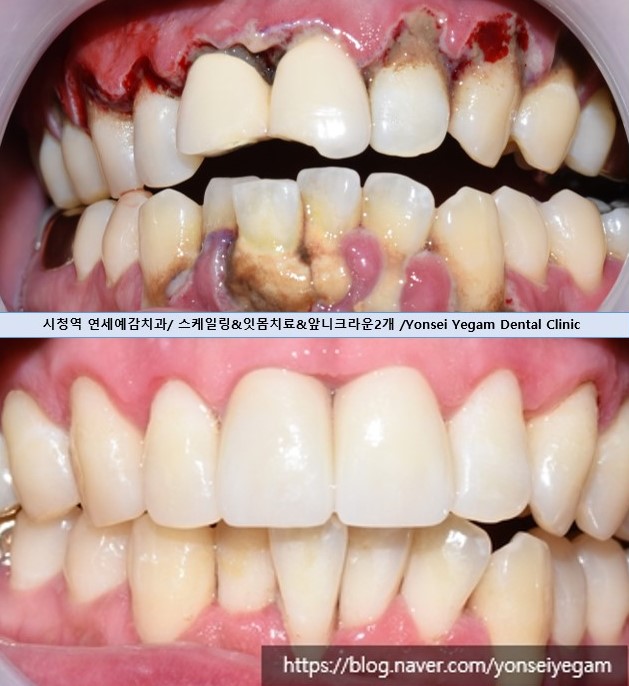 연세예감치과의원 대표 이미지