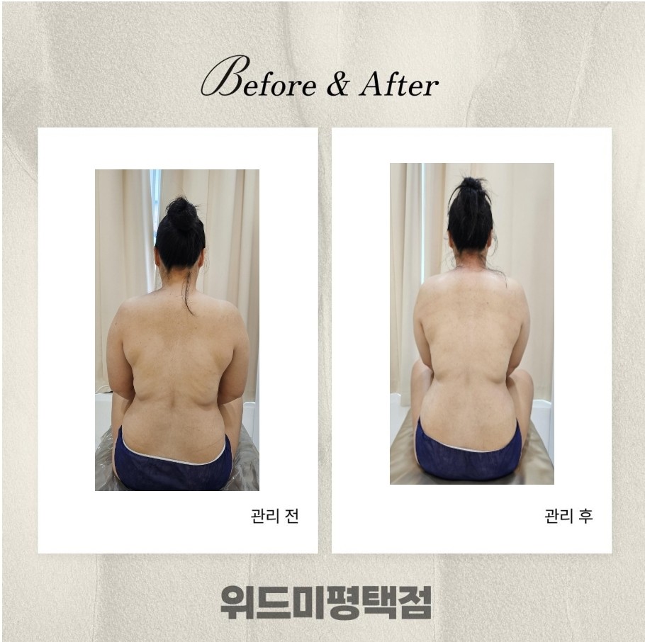 위드미 평택점