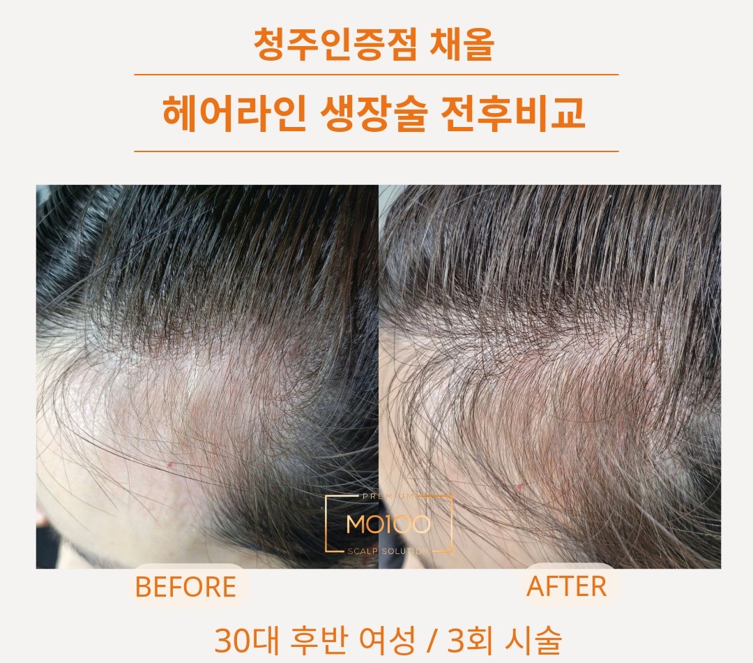 채올 대표 이미지