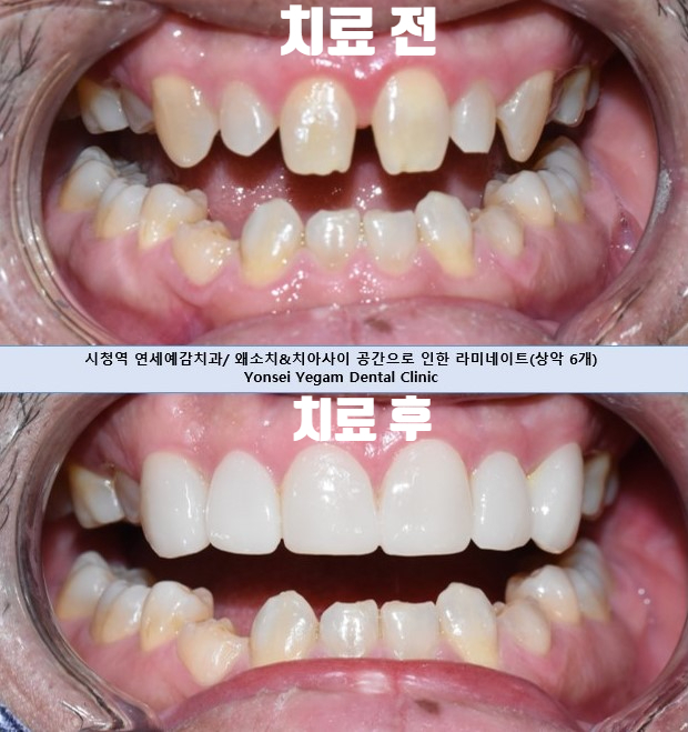 연세예감치과 대표 이미지