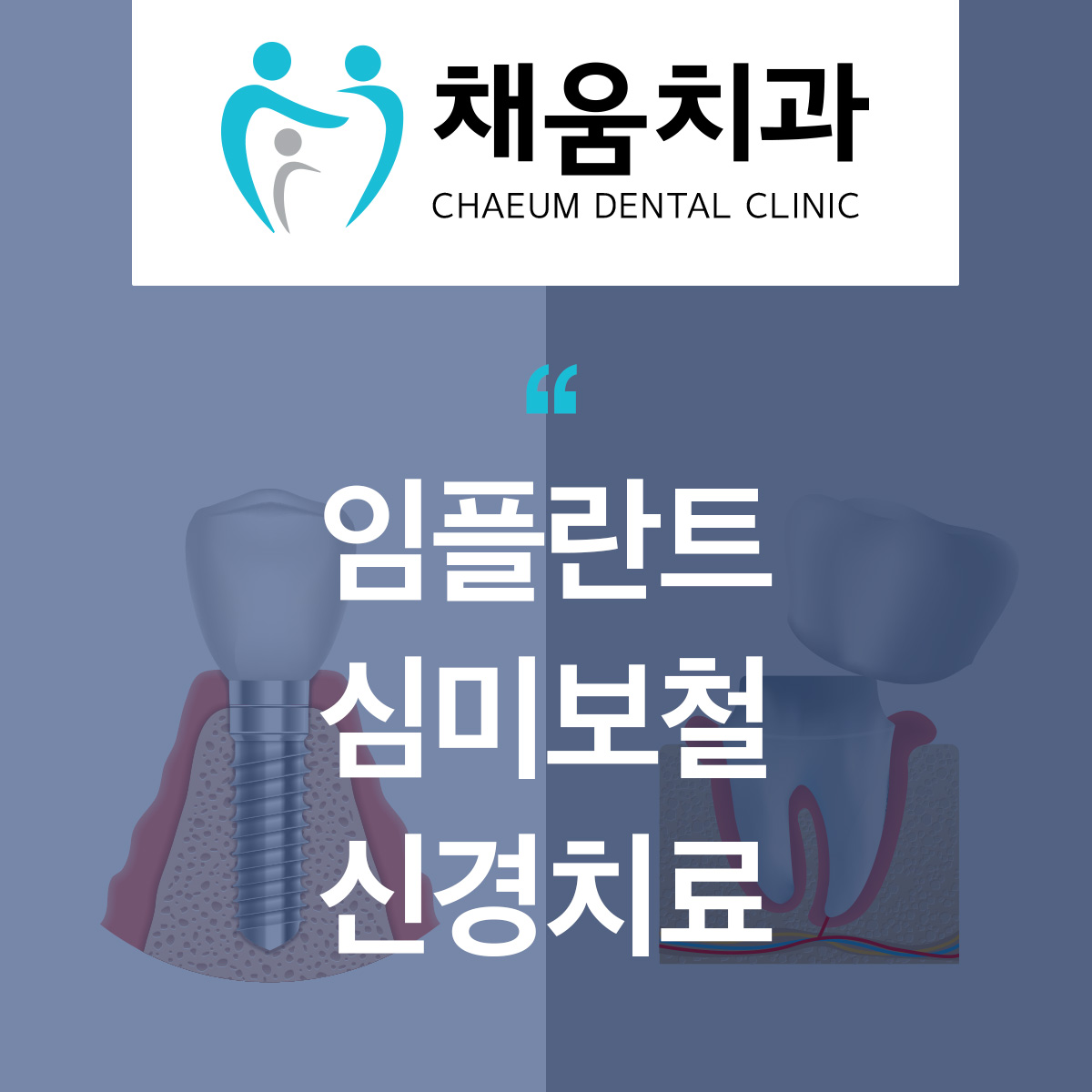 채움치과의원 대표 이미지