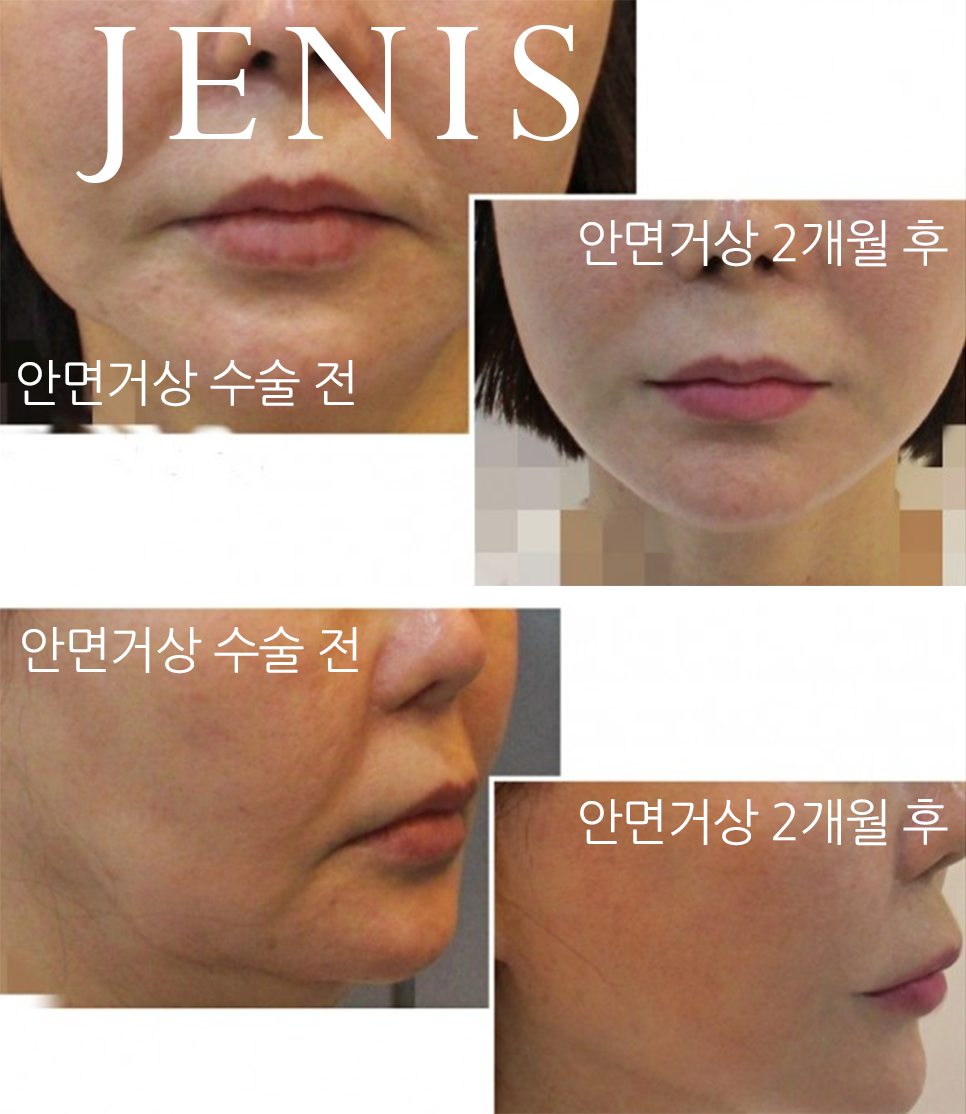 제니스의원 대표 이미지