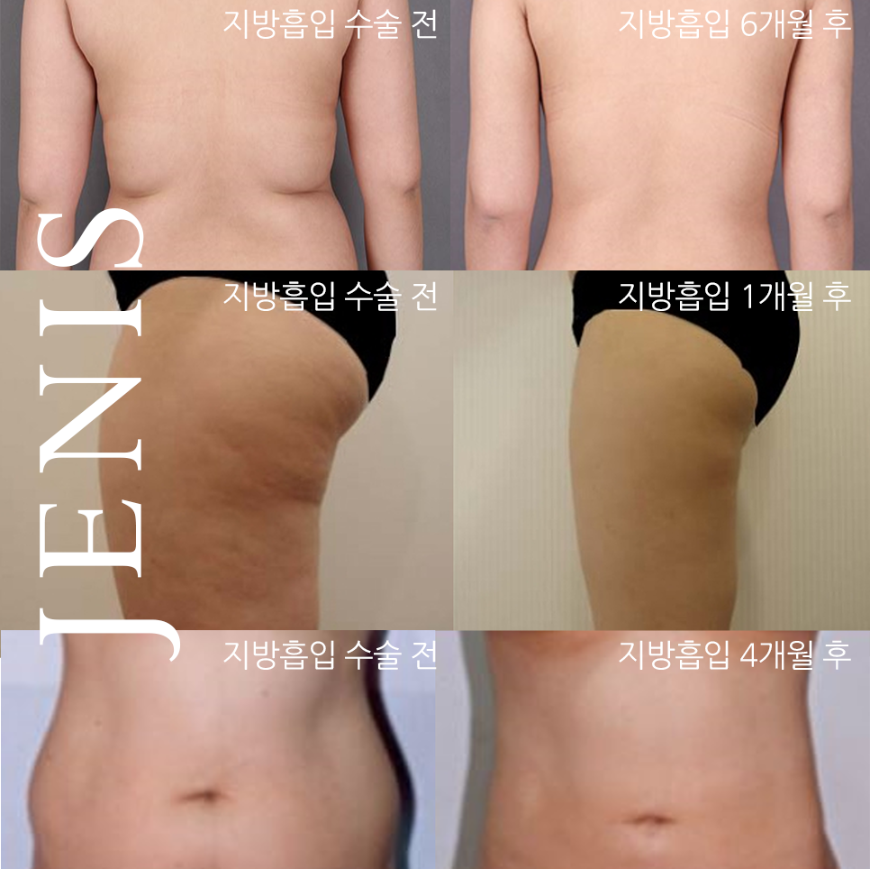 제니스의원 대표 이미지