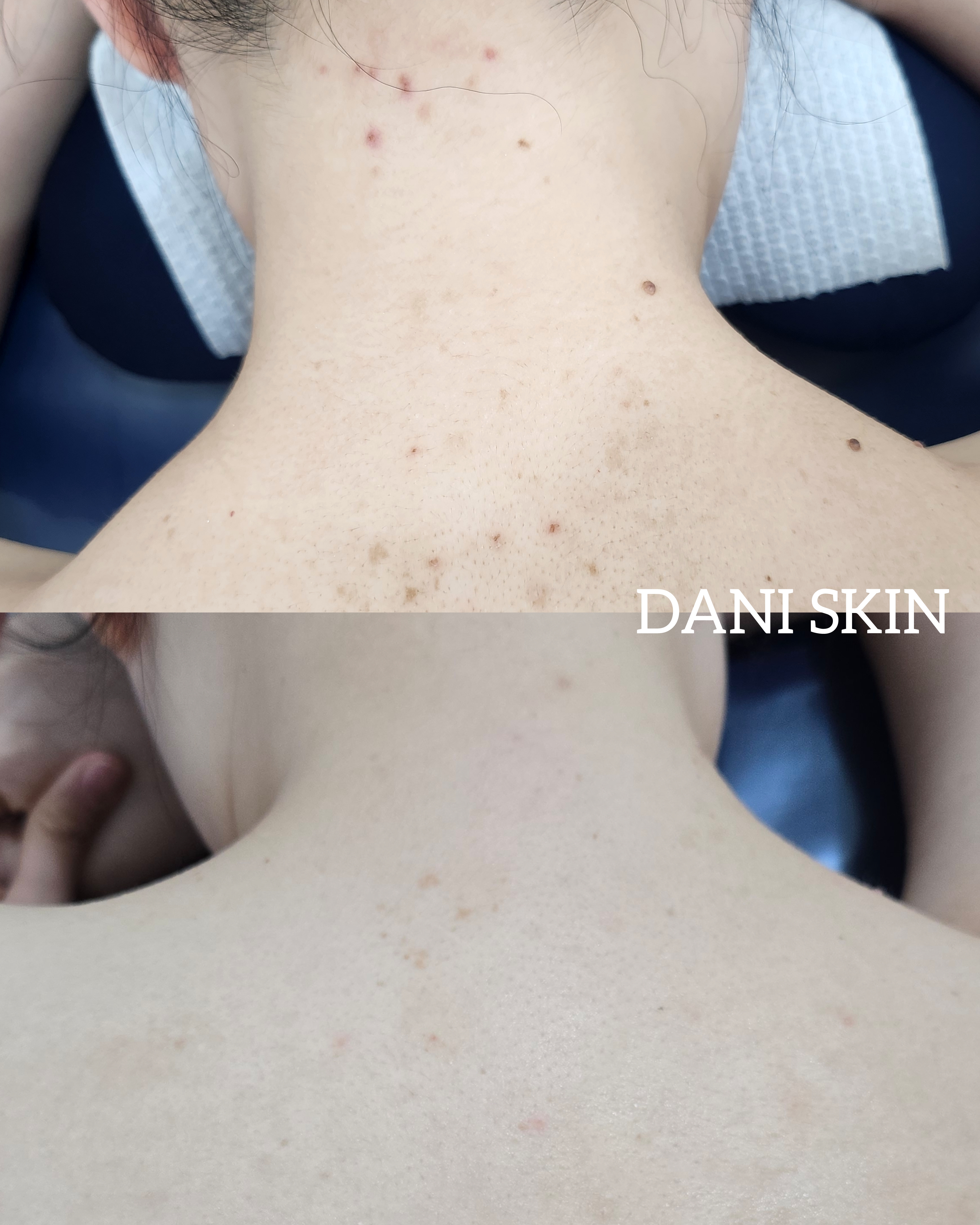 다니스킨 대표 이미지