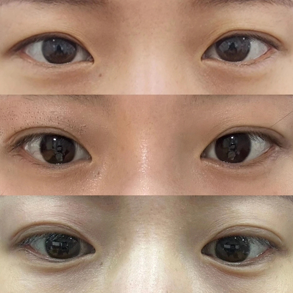 뷰티쏠대곡점 플라즈마블라스트