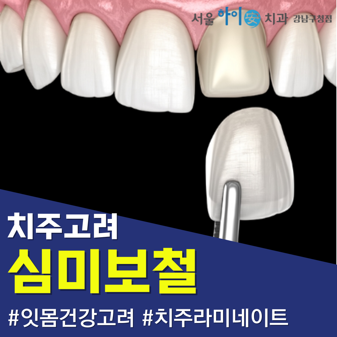 서울하이안치과의원 대표 이미지