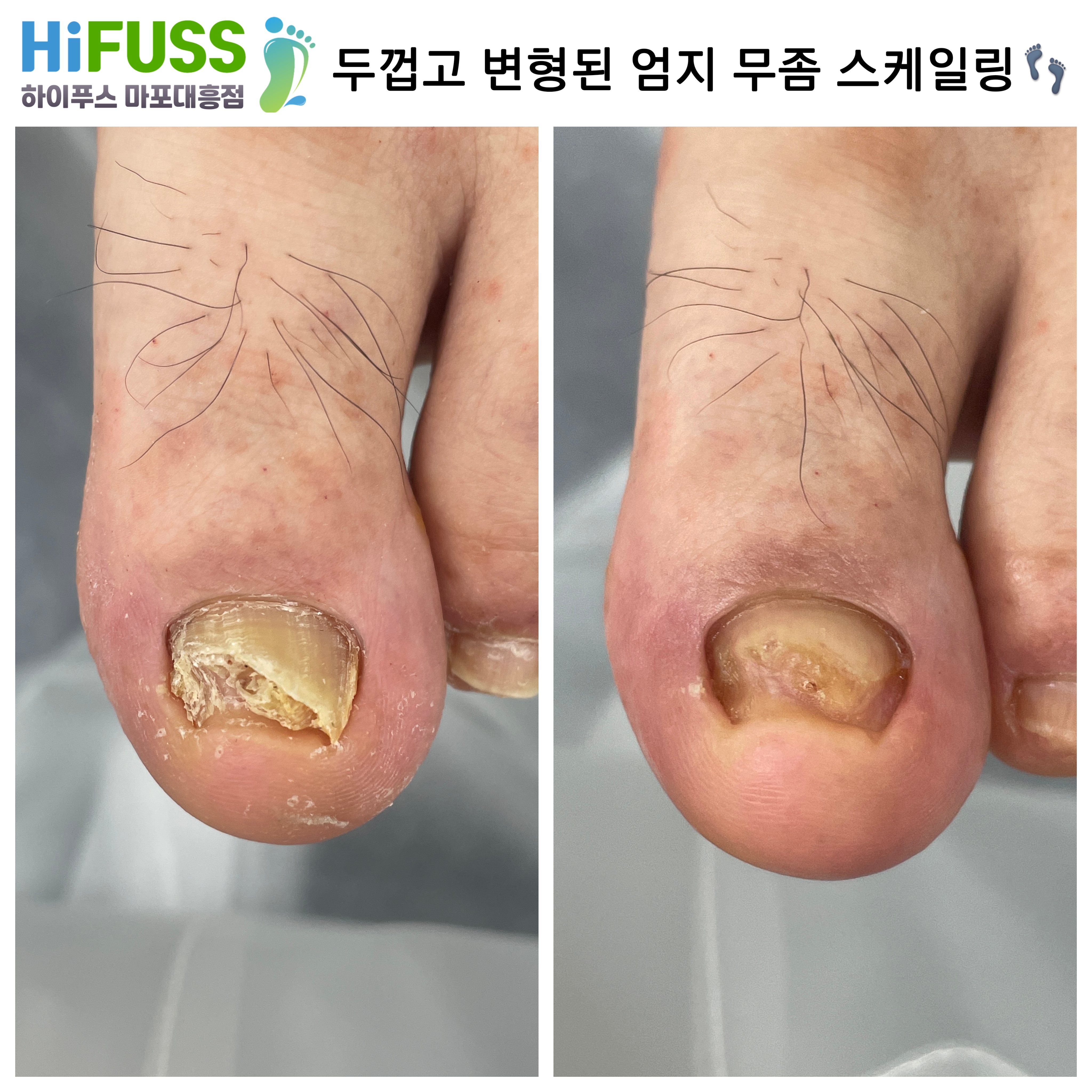 하이푸스 마포대흥점 대표 이미지