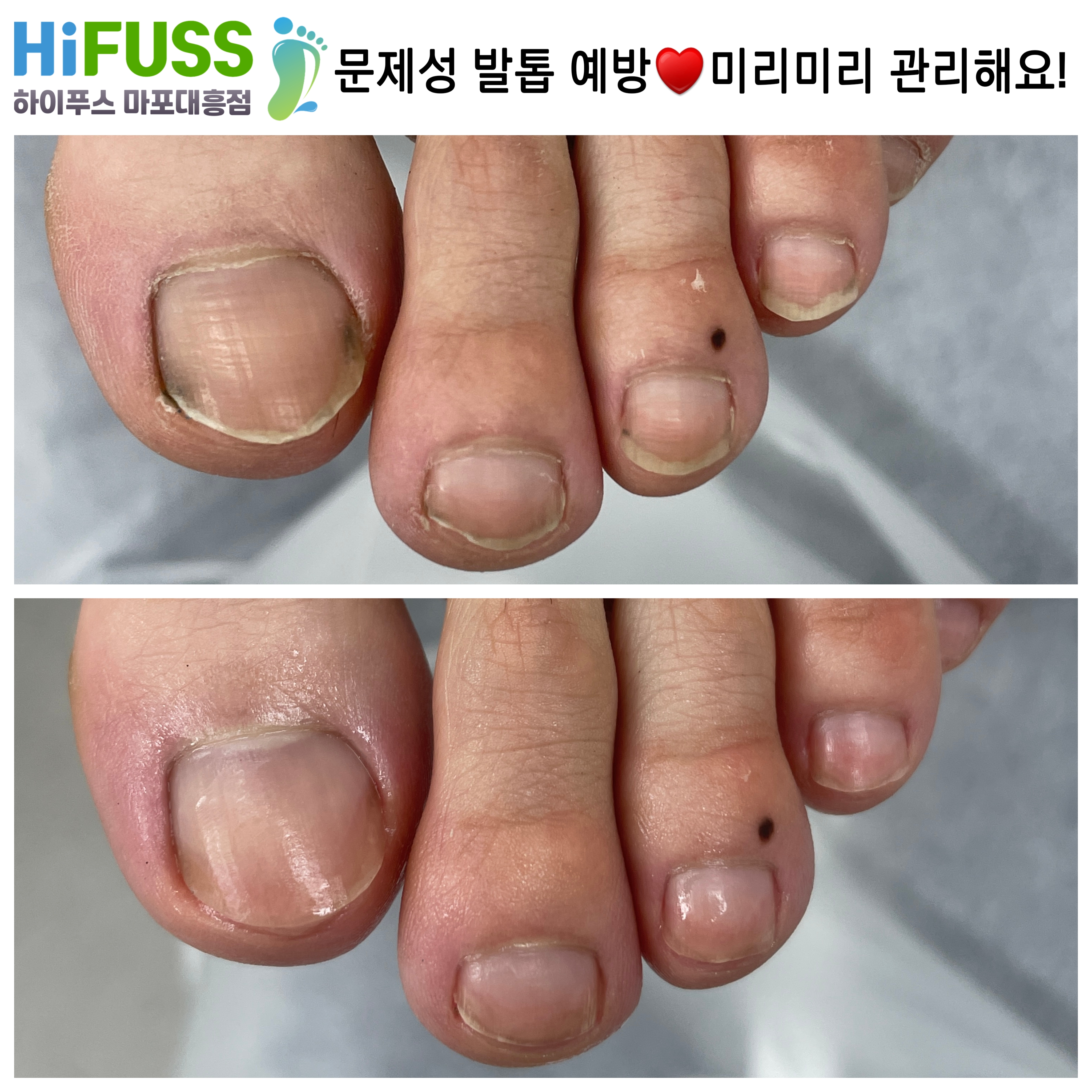 하이푸스 마포대흥점