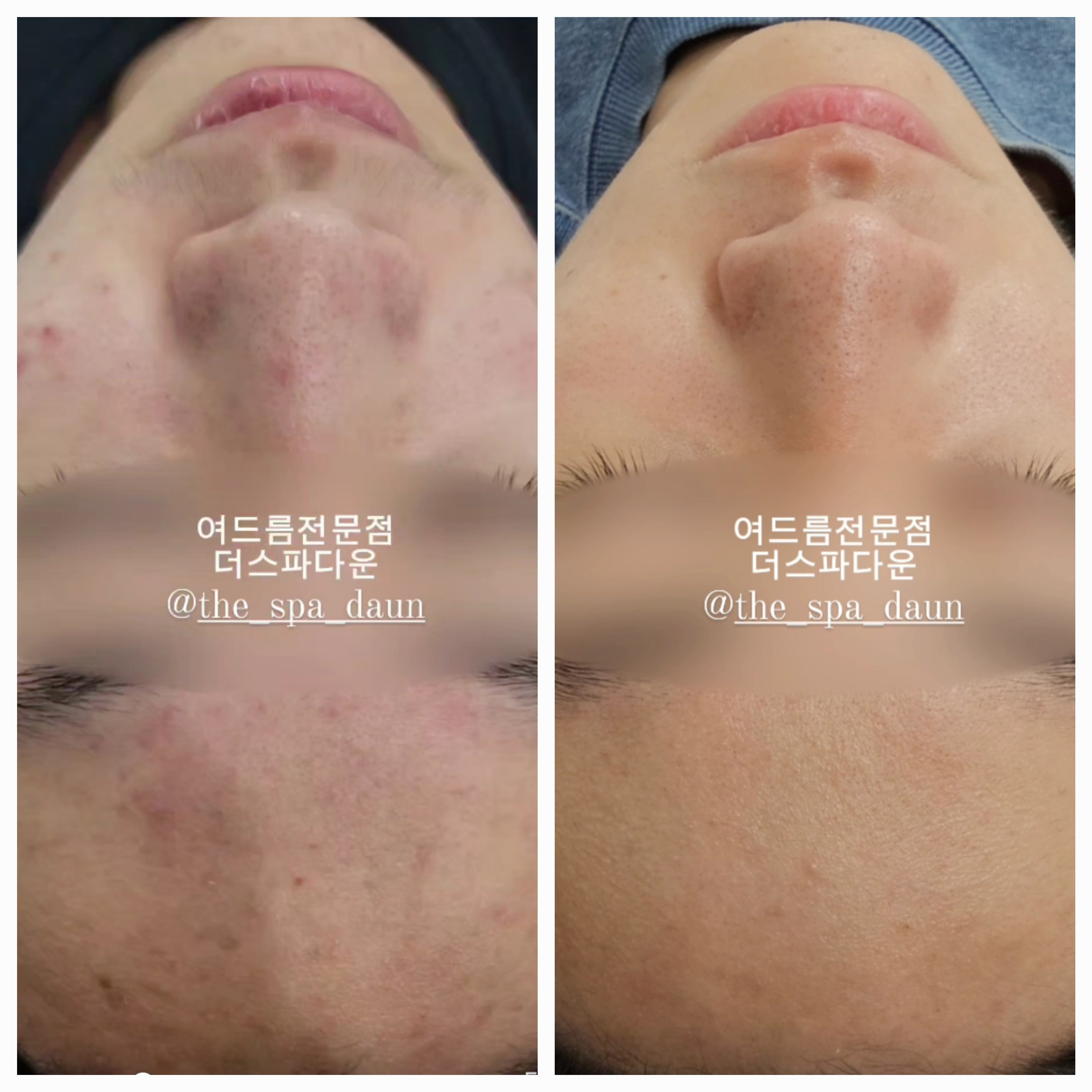더스파다운 대표 이미지