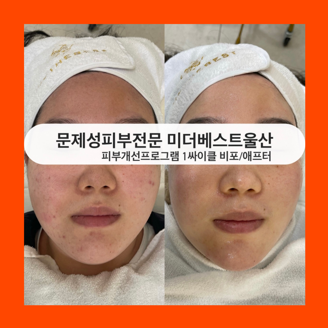 미더베스트 울산점