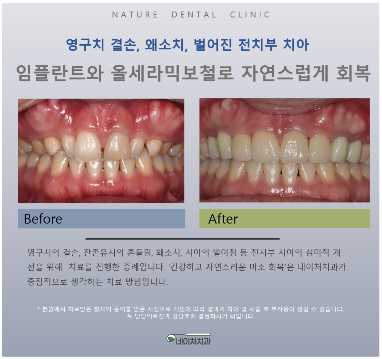 네이처치과의원 대표 이미지