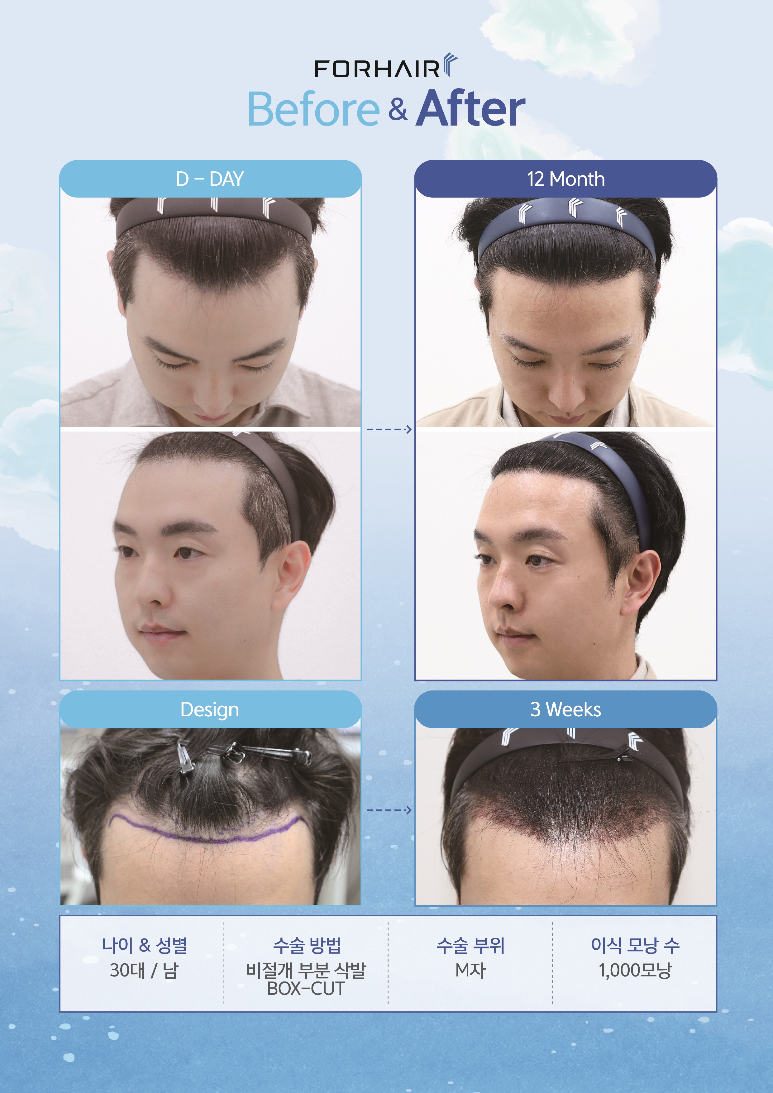 포헤어의원 서울점 대표 이미지