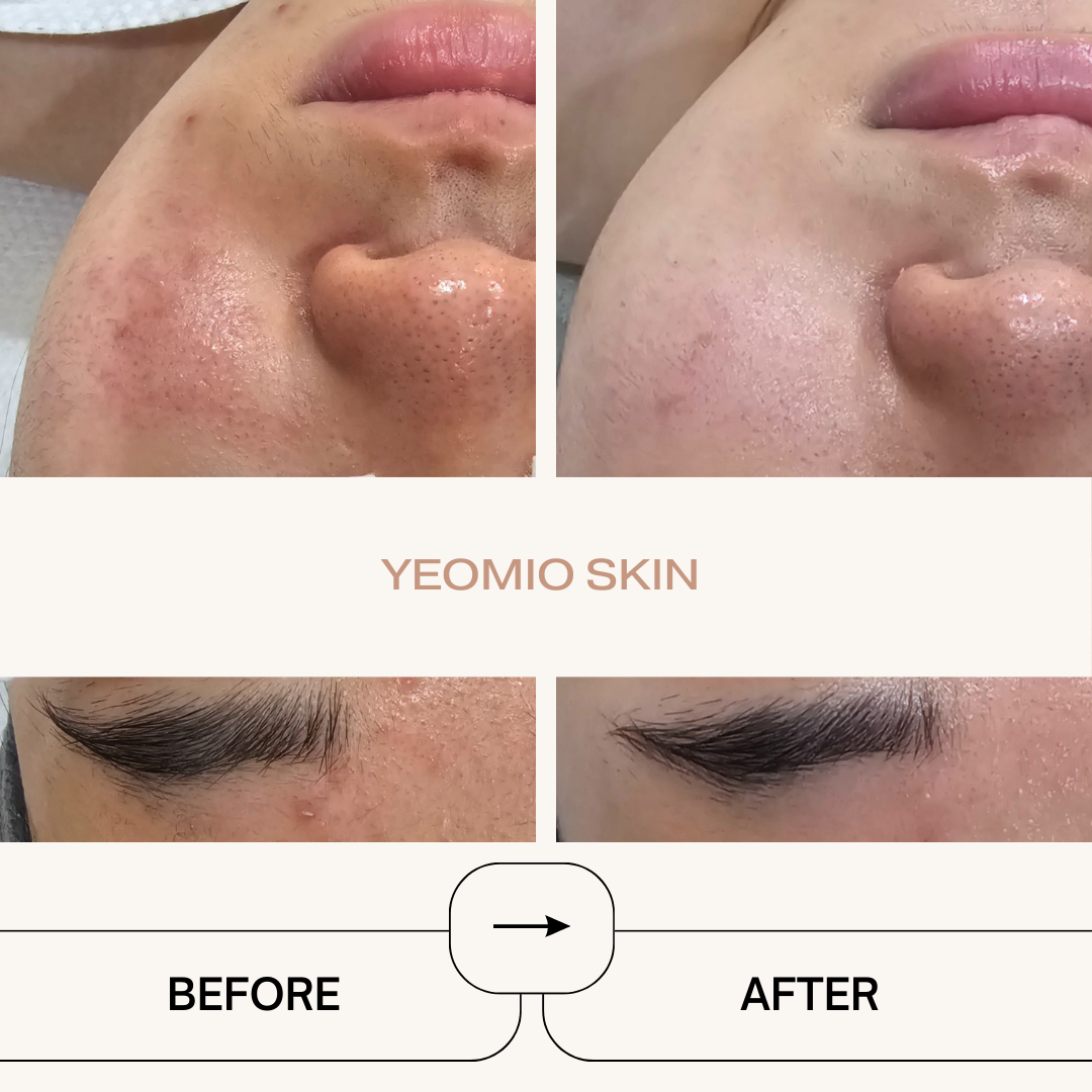 예오미오 스킨케어 의정부금오본점 대표 이미지
