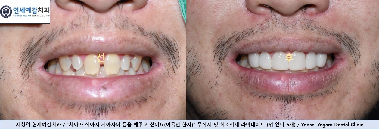 연세예감치과의원 대표 이미지