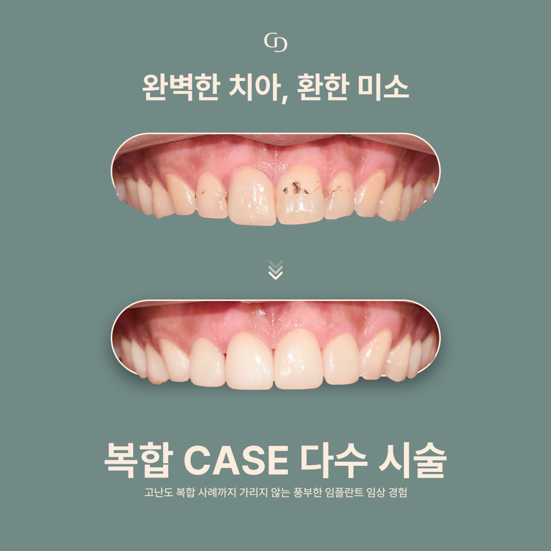 갤러리치과의원 대표 이미지