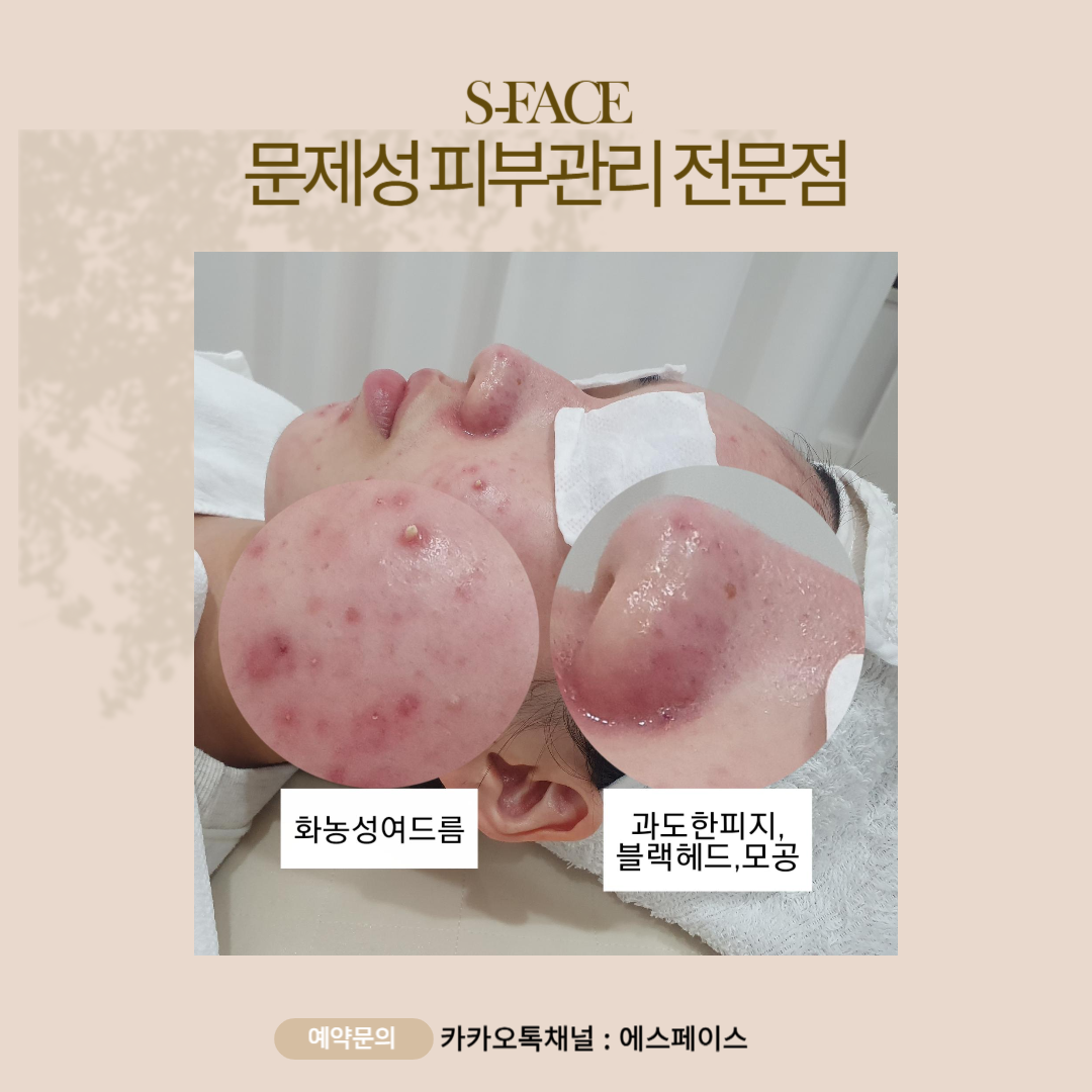 에스페이스 대표 이미지