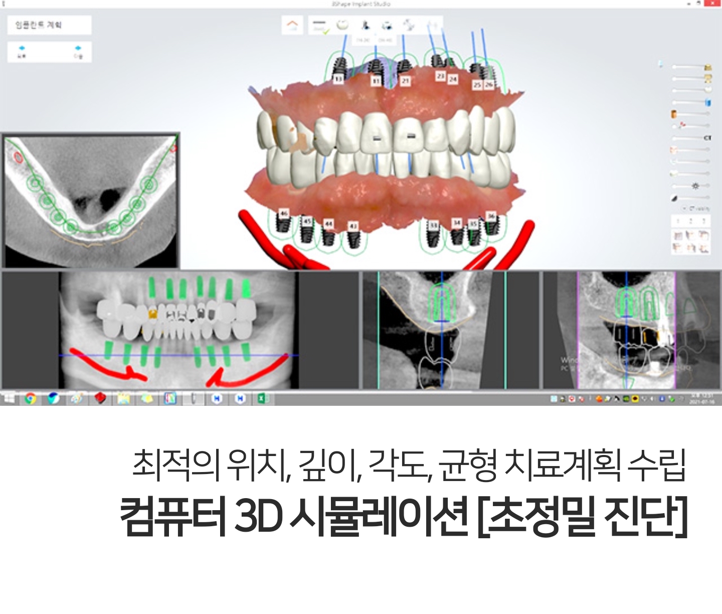 크림치과의원 대표 이미지