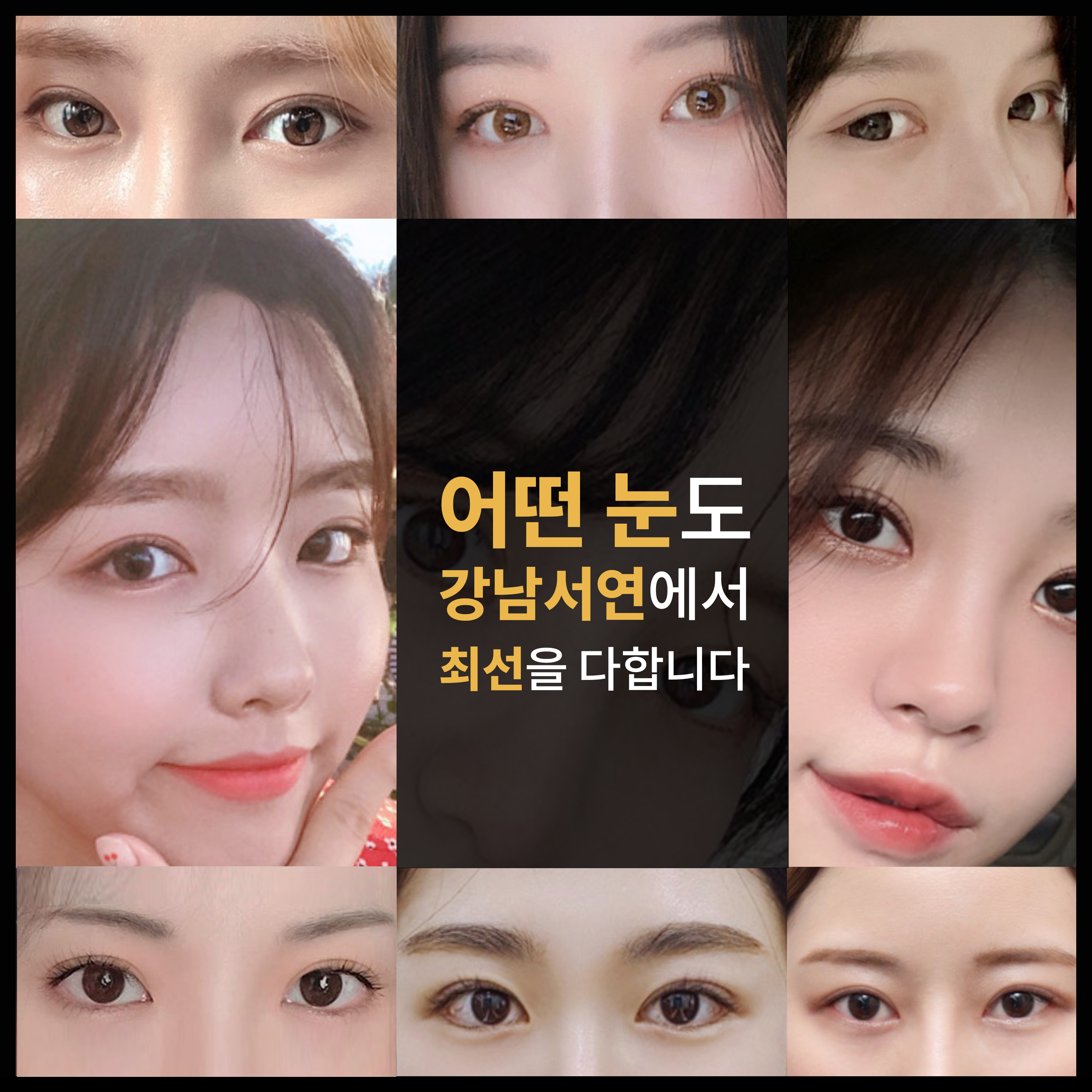 강남서연성형외과의원 대표 이미지