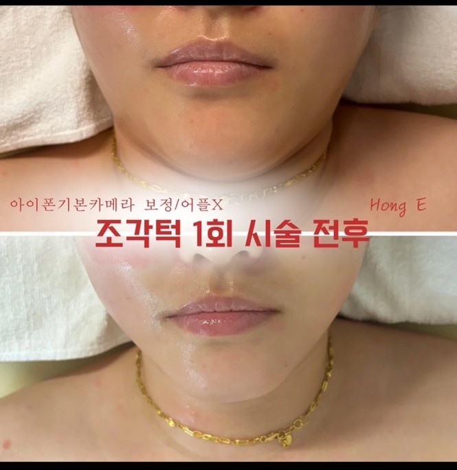 가현스킨&바디