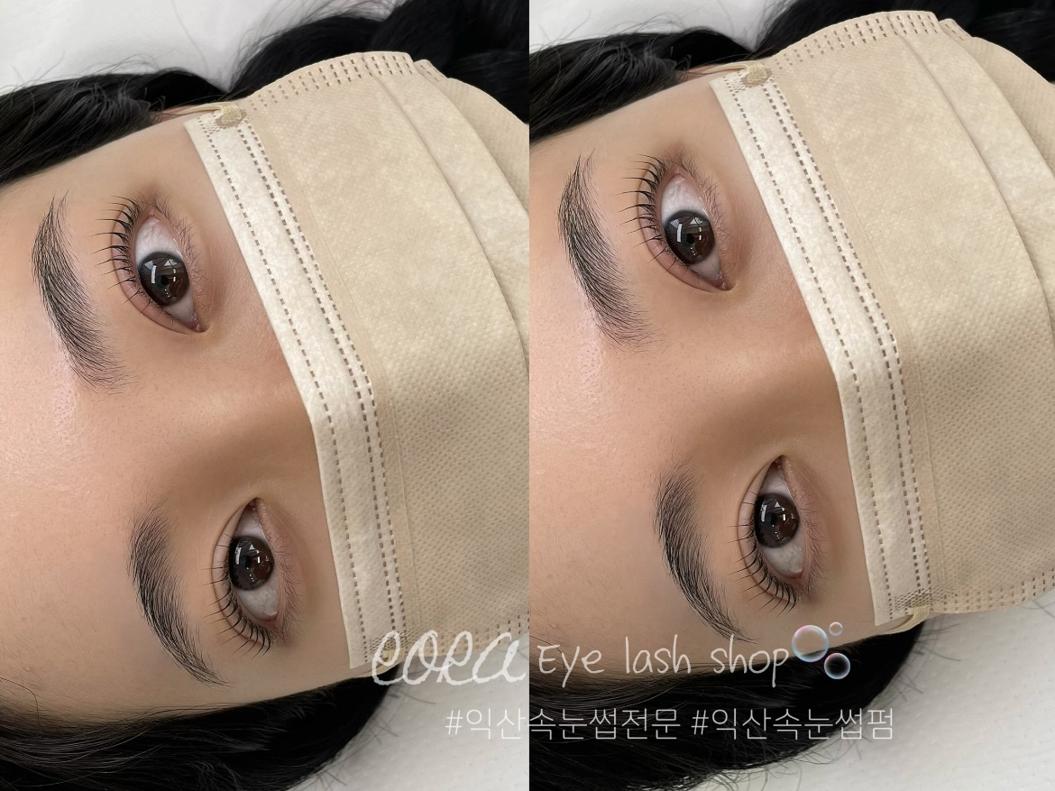로라 대표 이미지