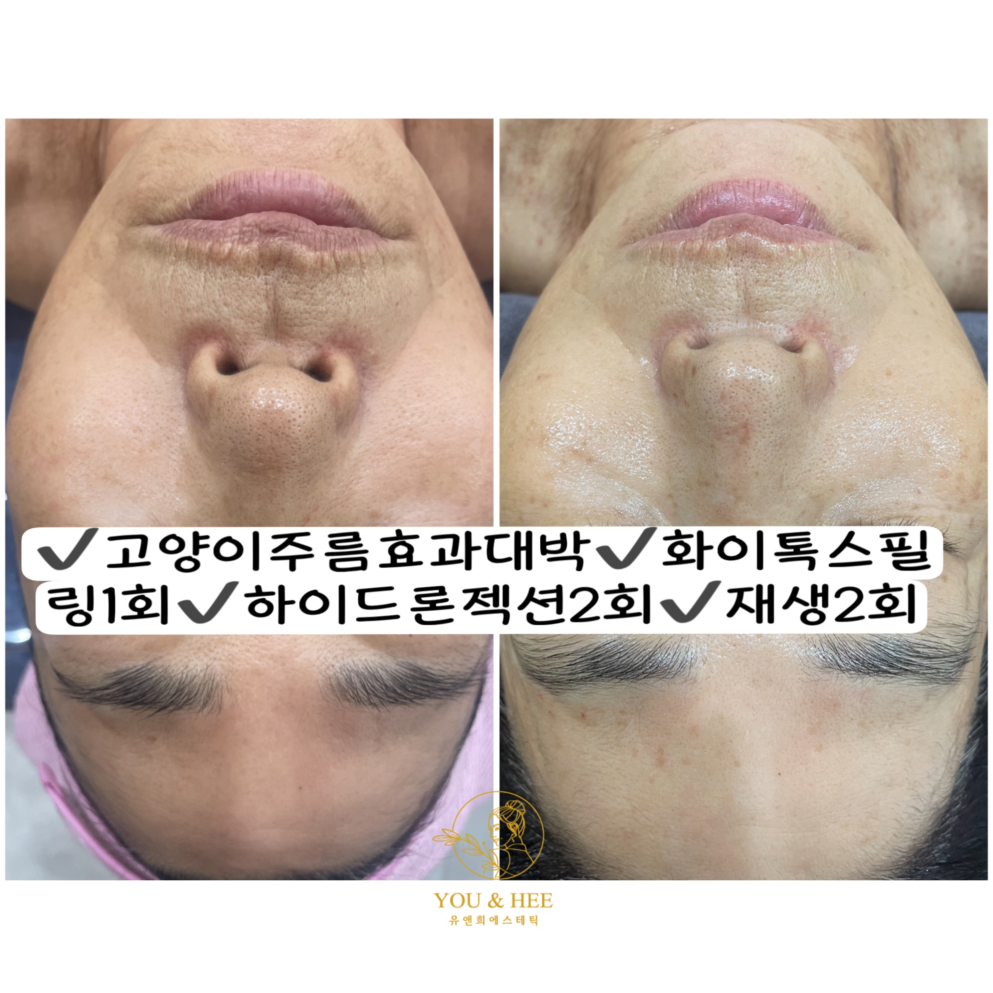 유앤희에스테틱 광주첨단점