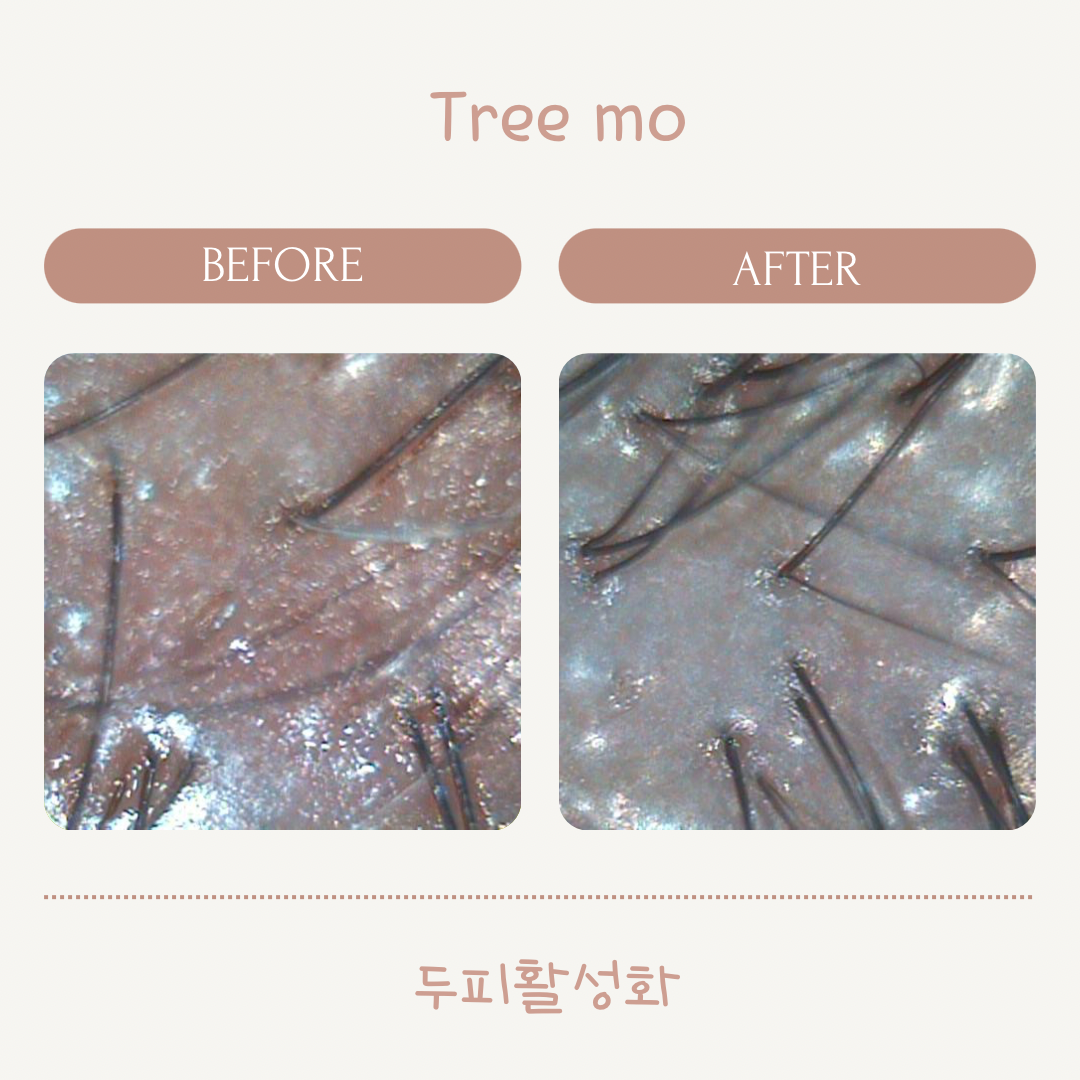 트리모 본점 대표 이미지
