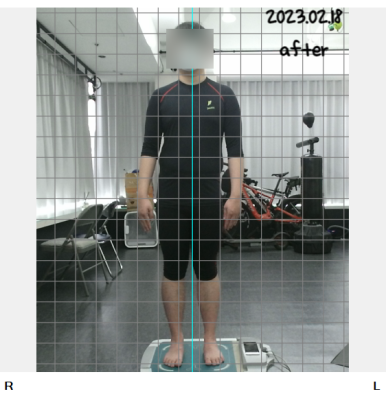 시너제틱스 재활교정 전문센터