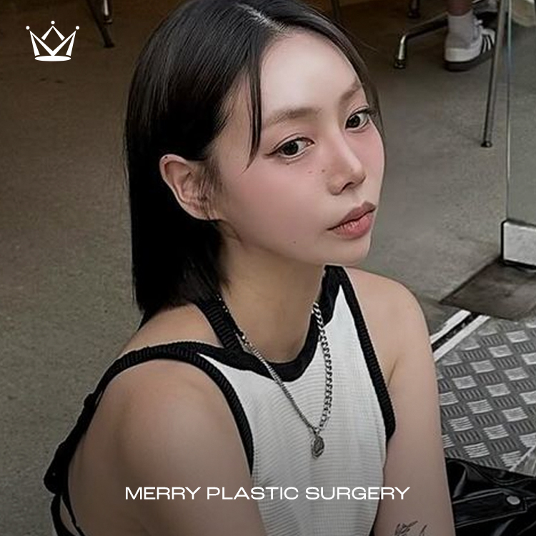 메리성형외과의원 대표 이미지