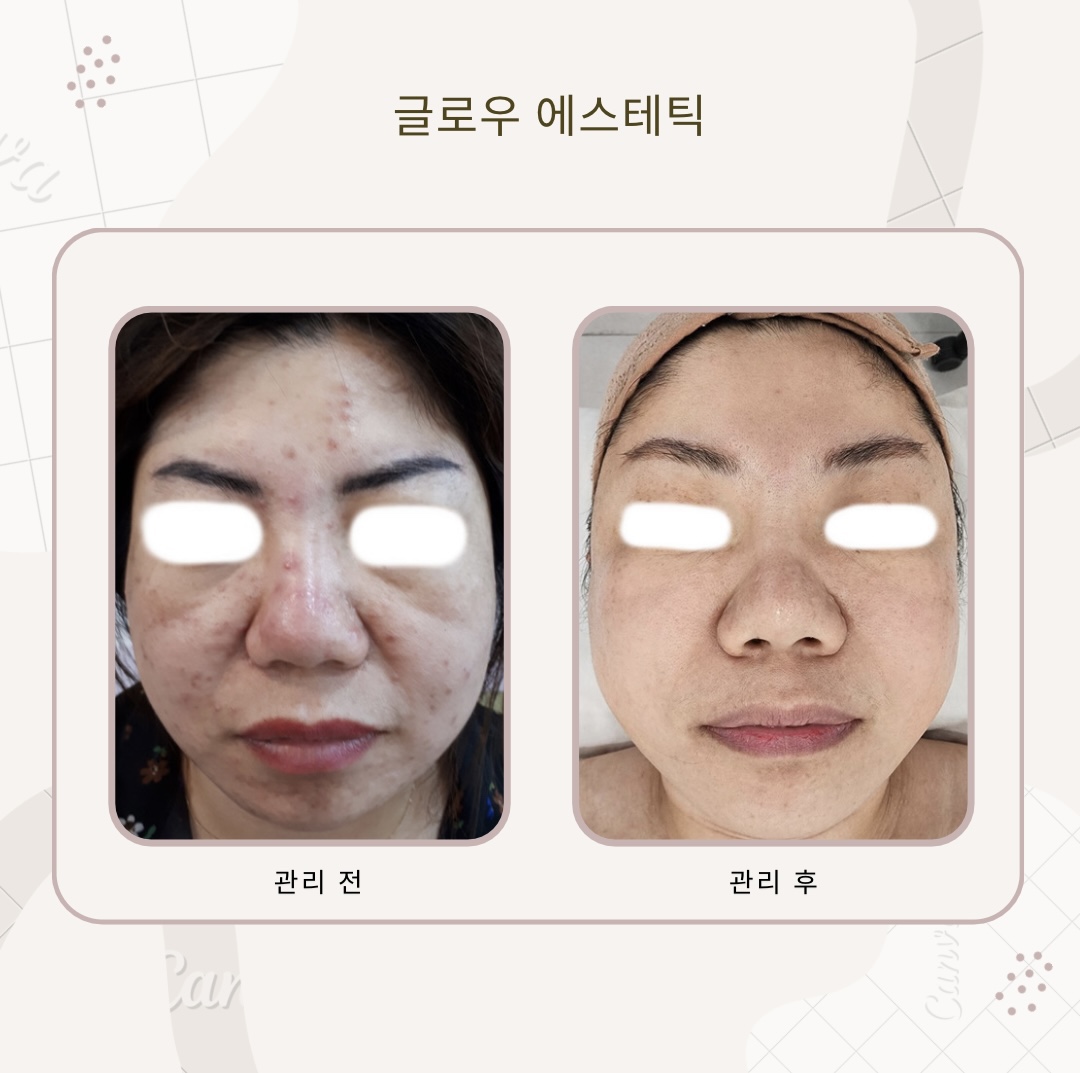 글로우 에스테틱 대표 이미지