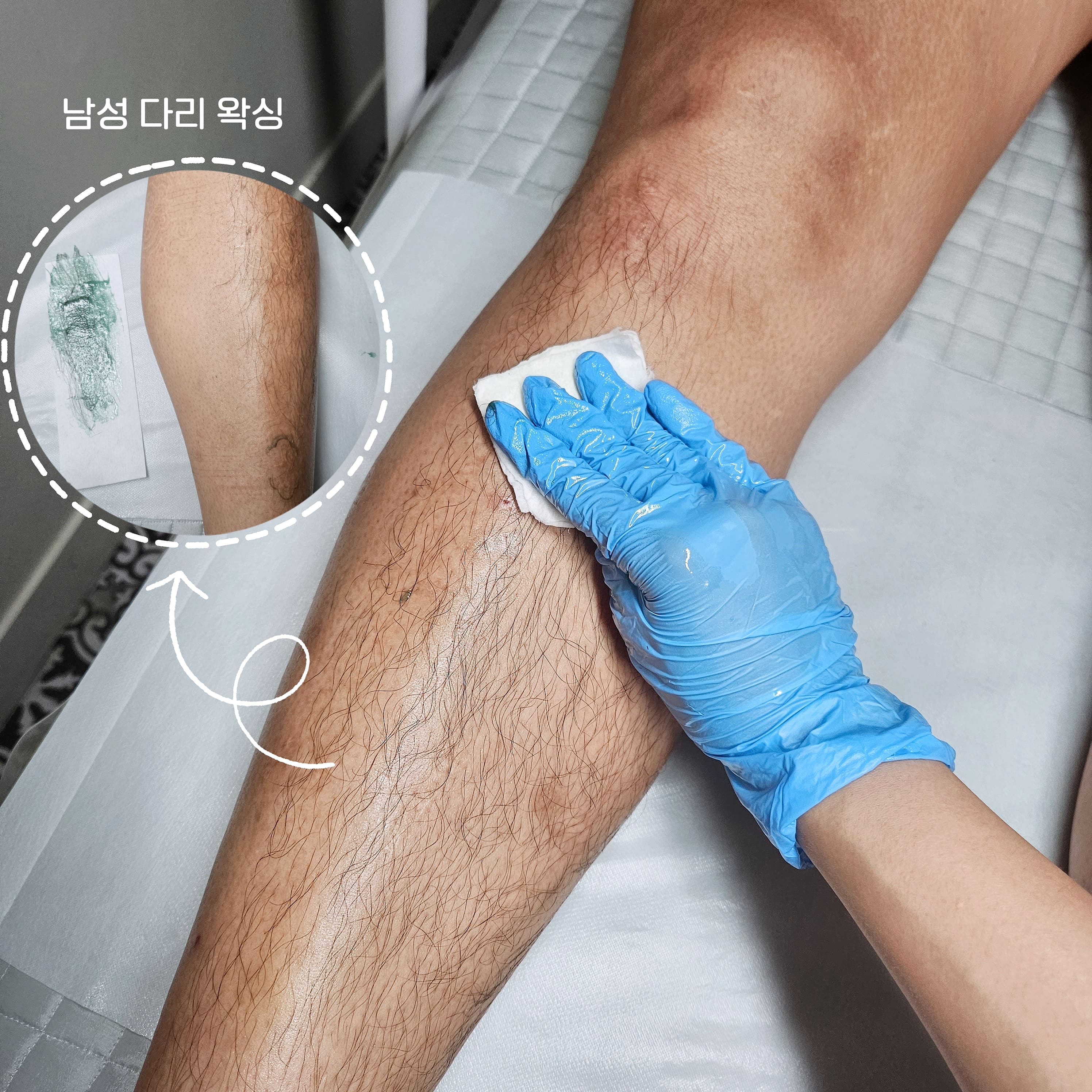 단미