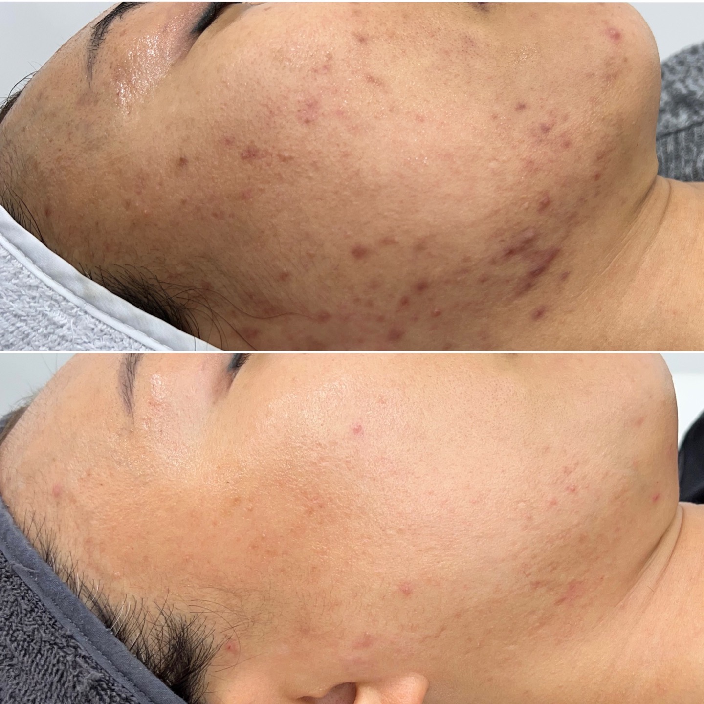 루이뷰티 대표 이미지