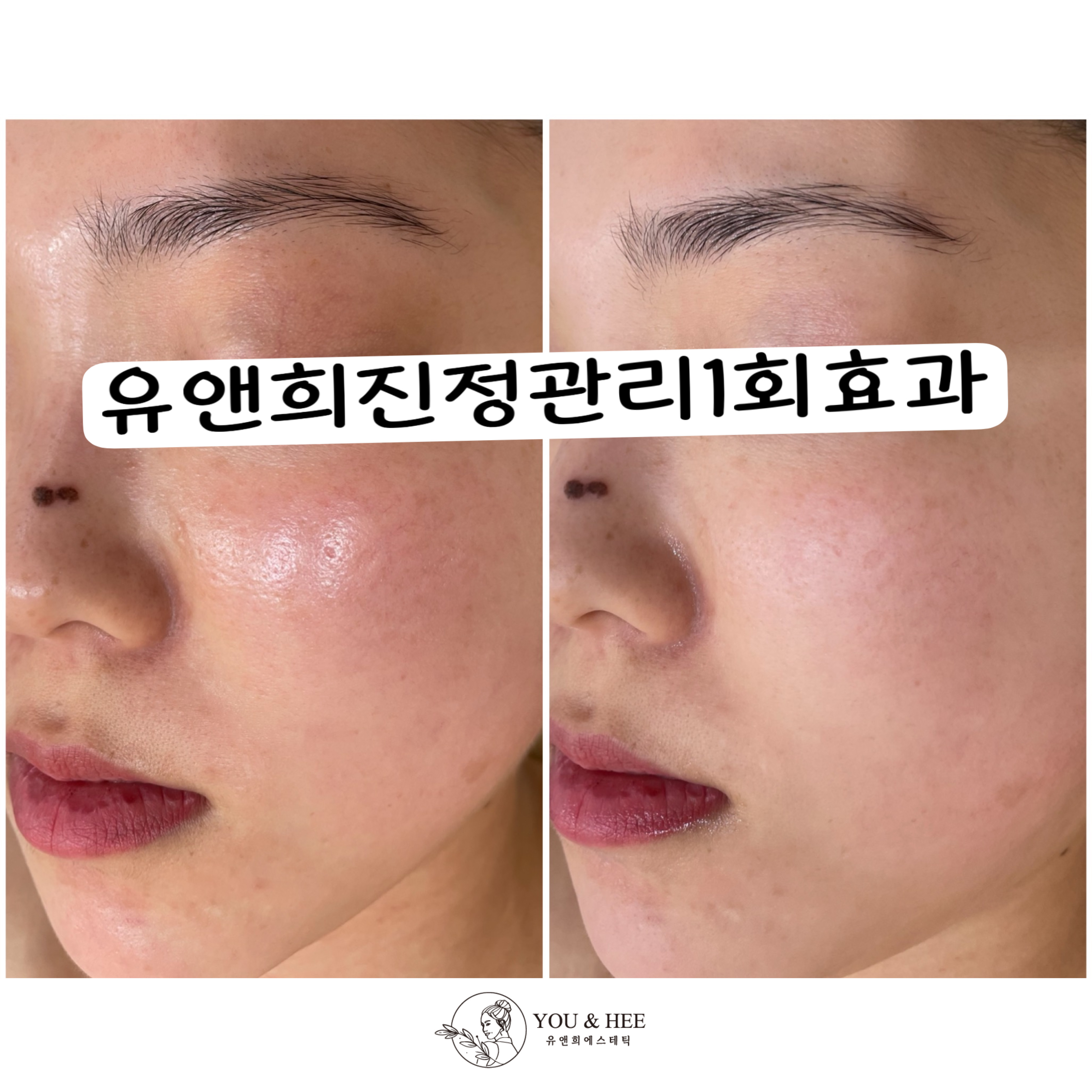 유앤희에스테틱 광주첨단점