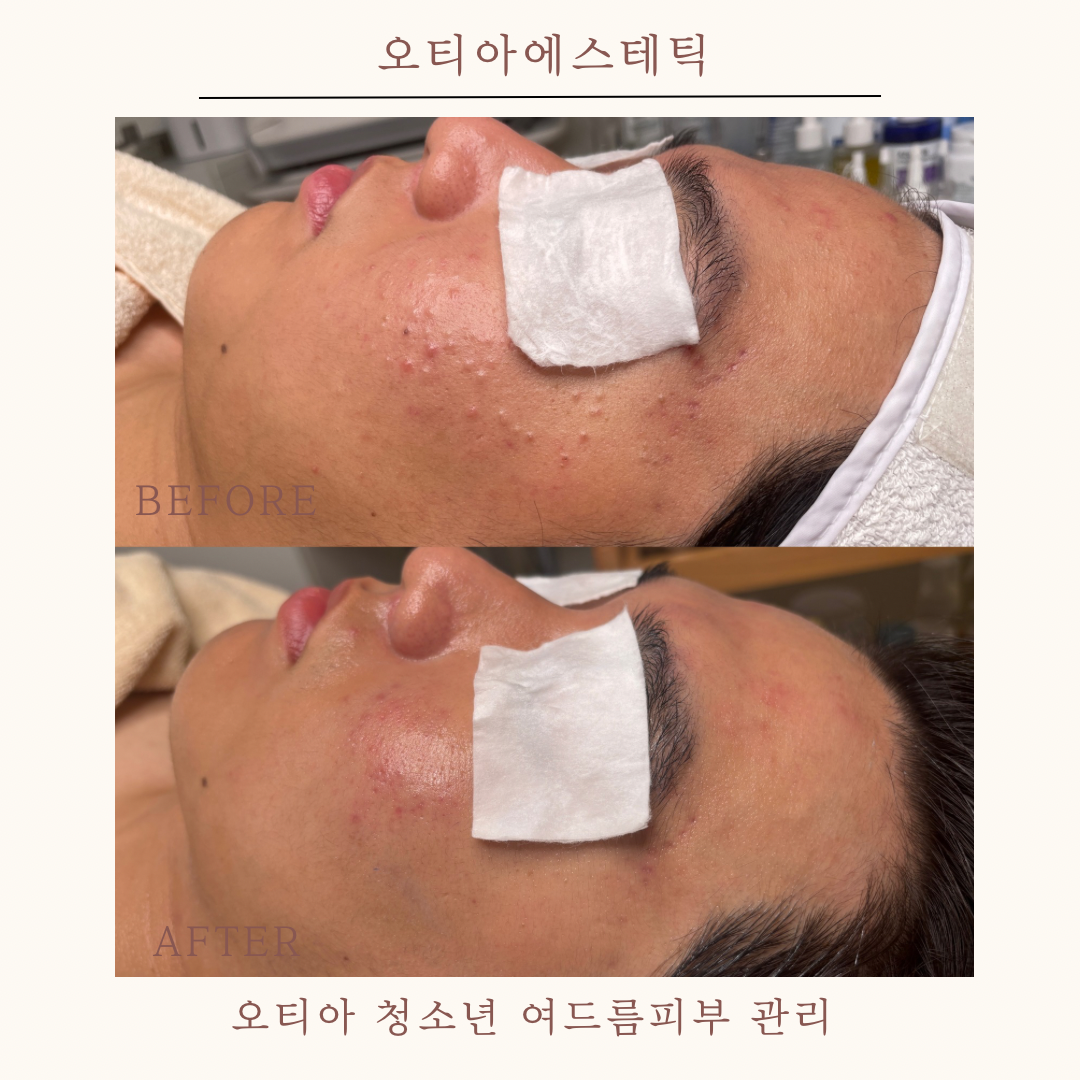 오티아에스테틱