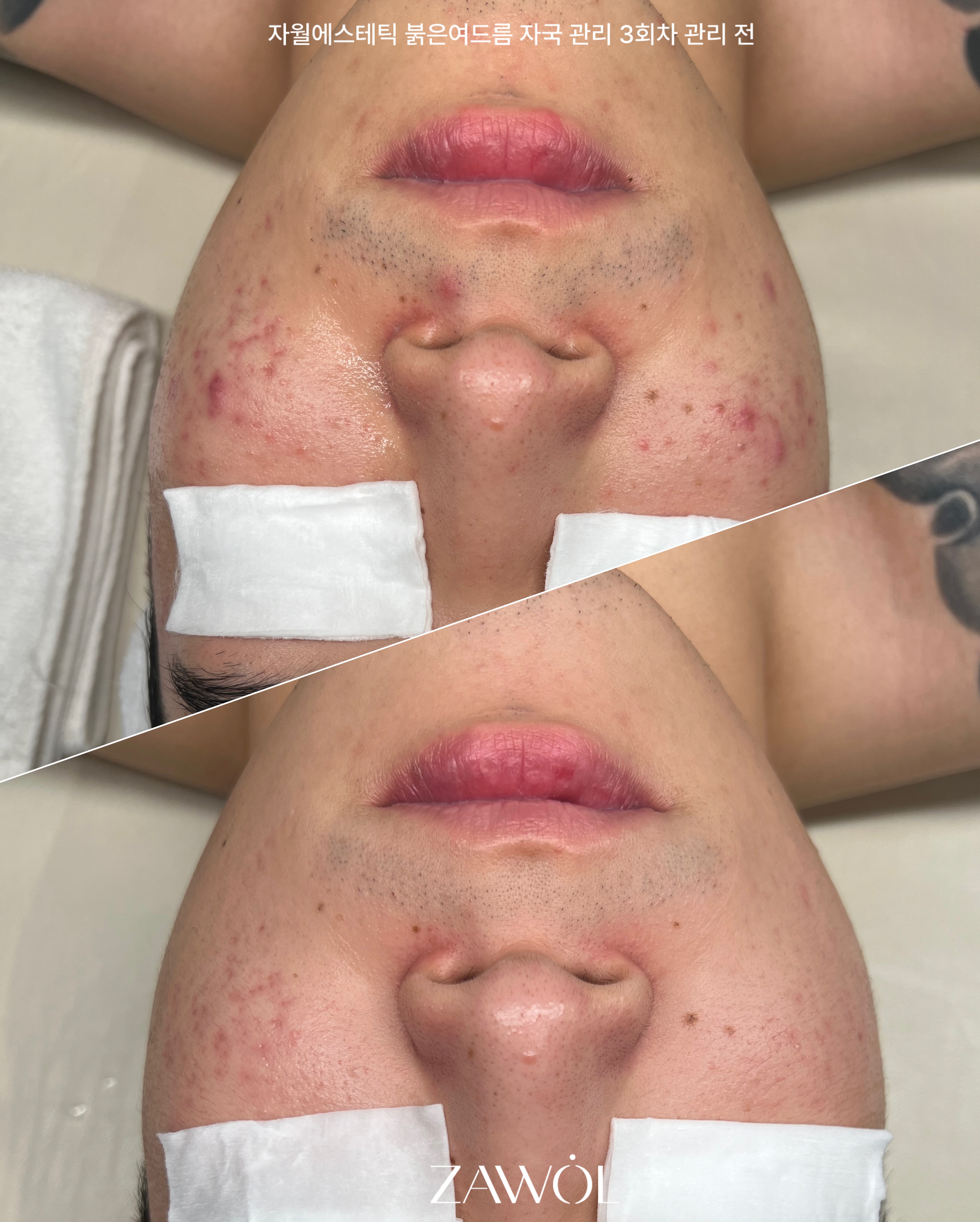 자월에스테틱 대표 이미지