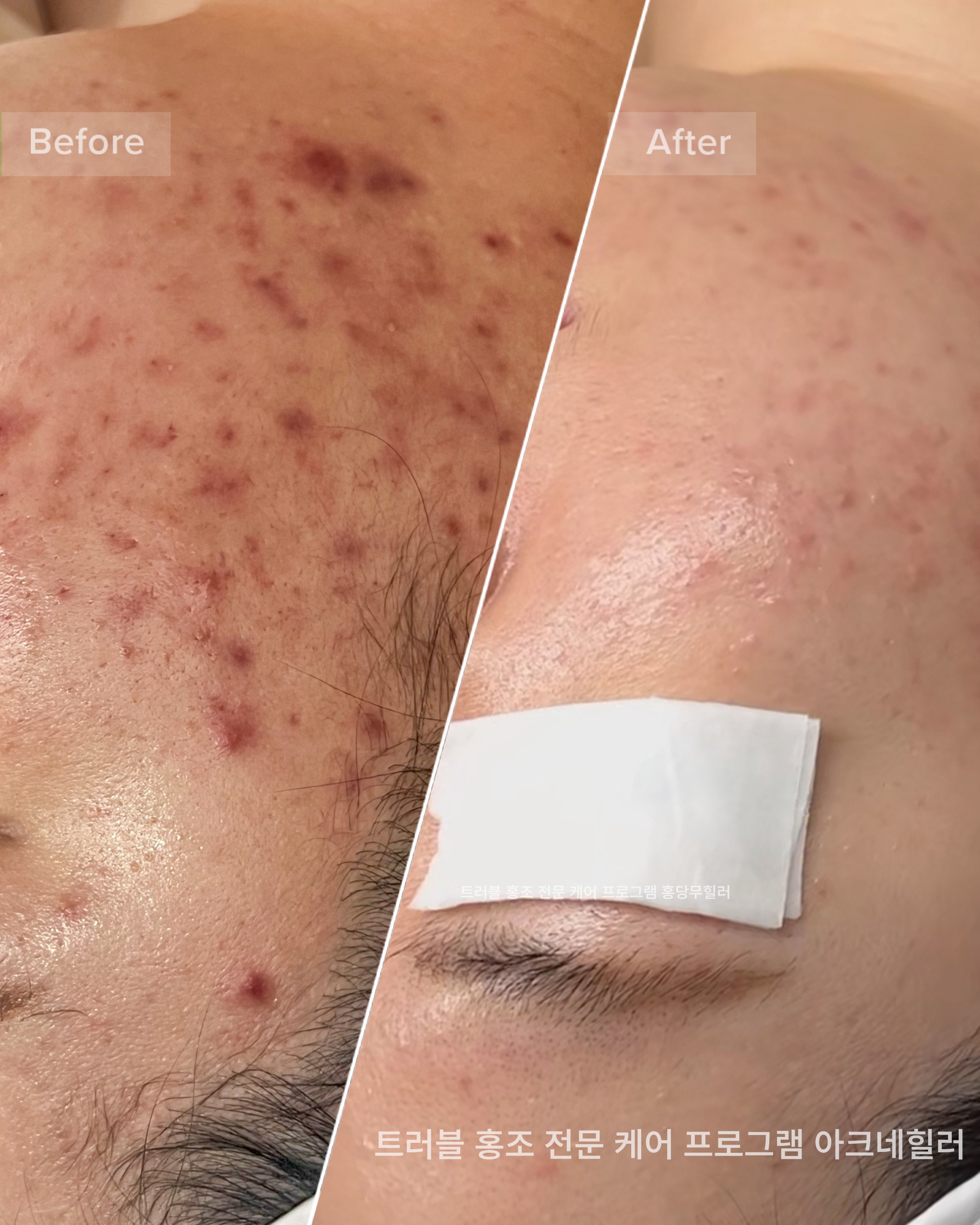 자월에스테틱 대표 이미지