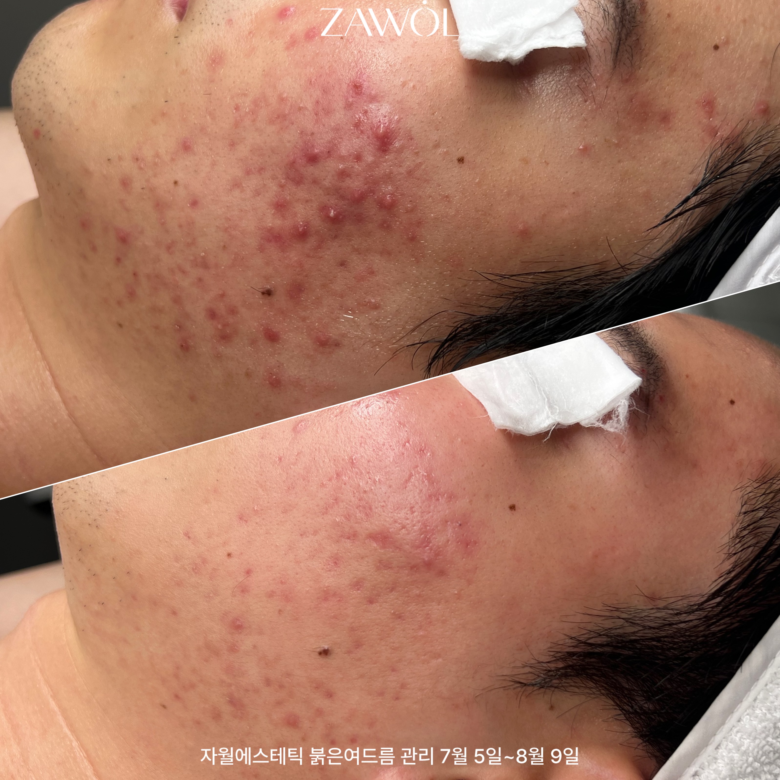 자월에스테틱 대표 이미지