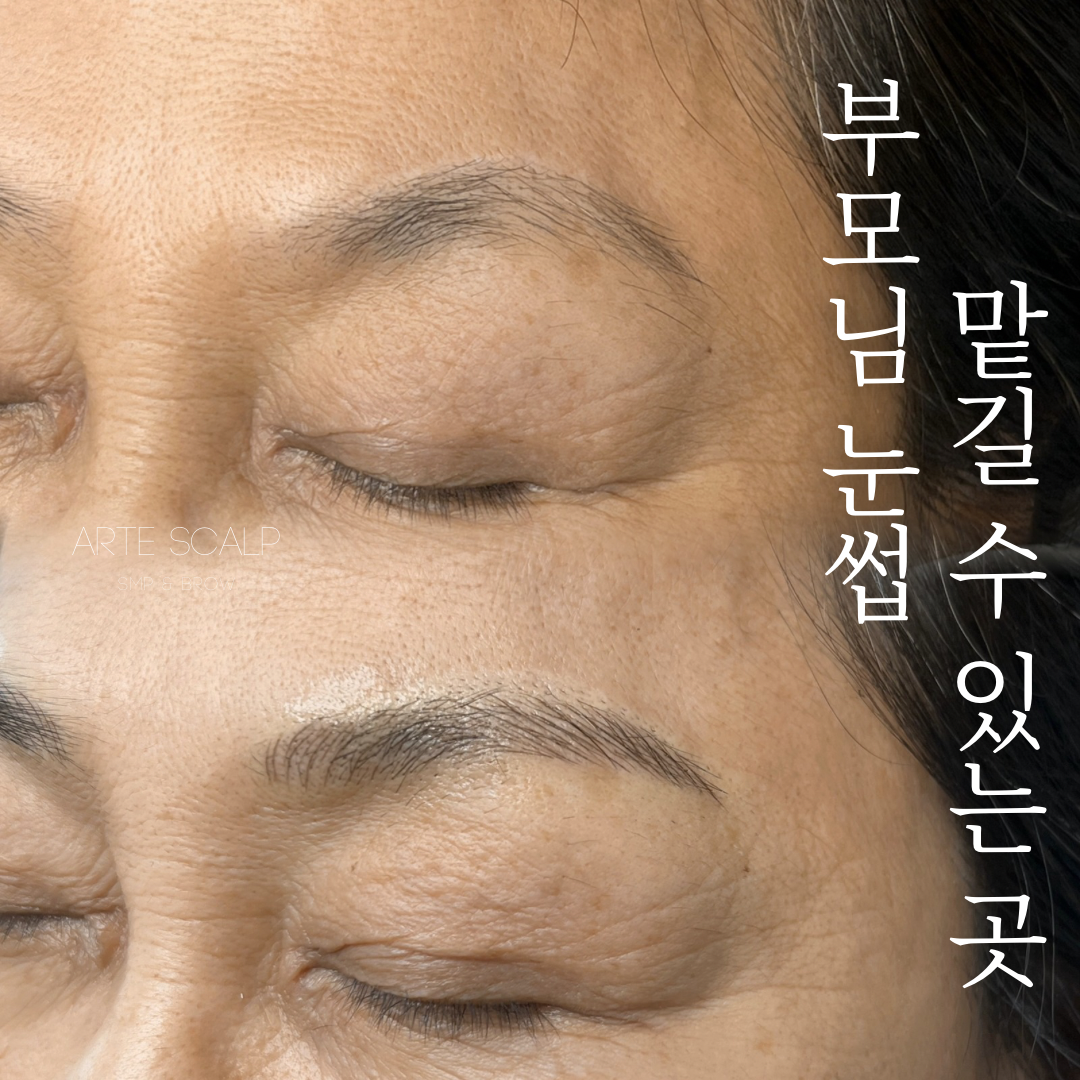 아르떼스칼프