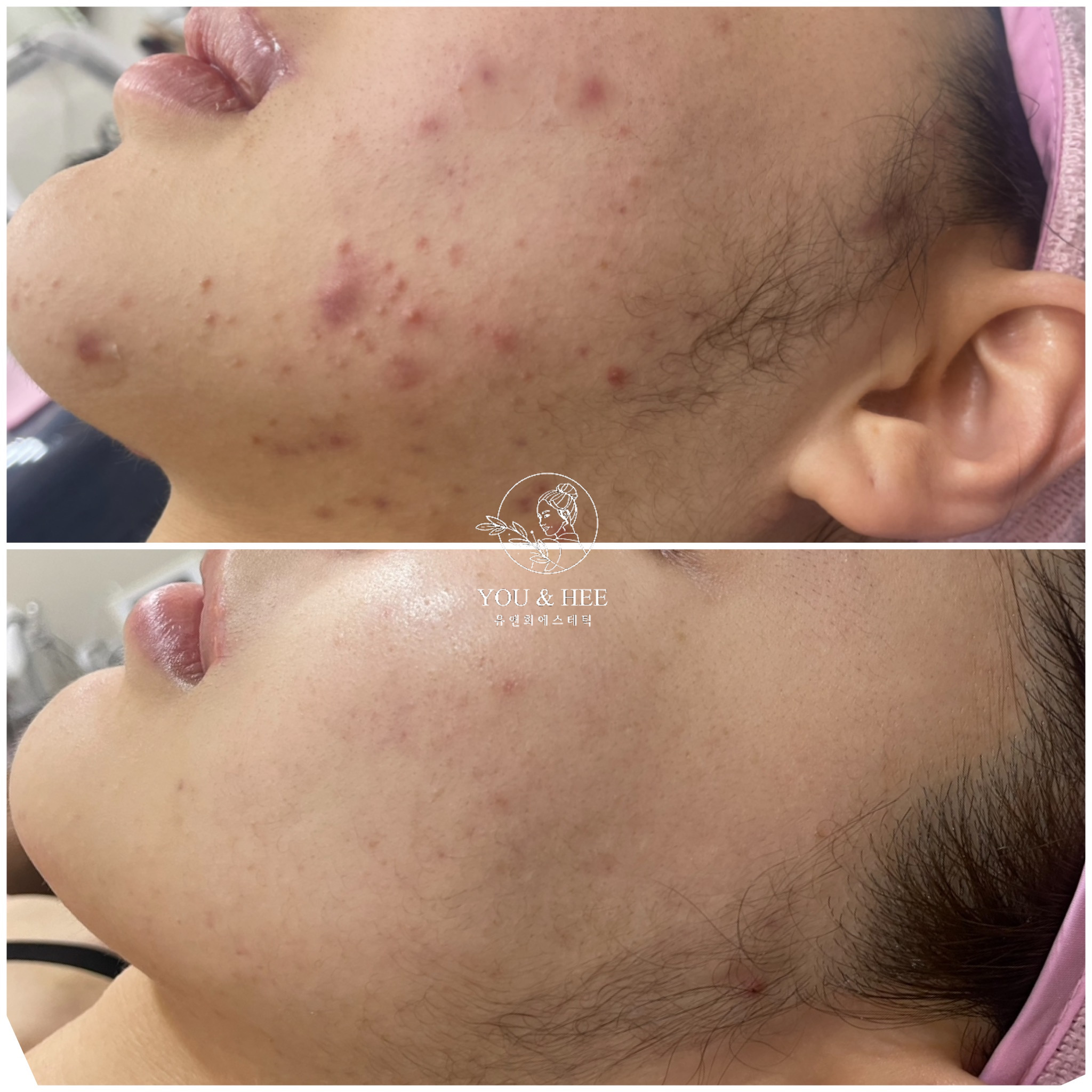 유앤희에스테틱 광주첨단점 대표 이미지
