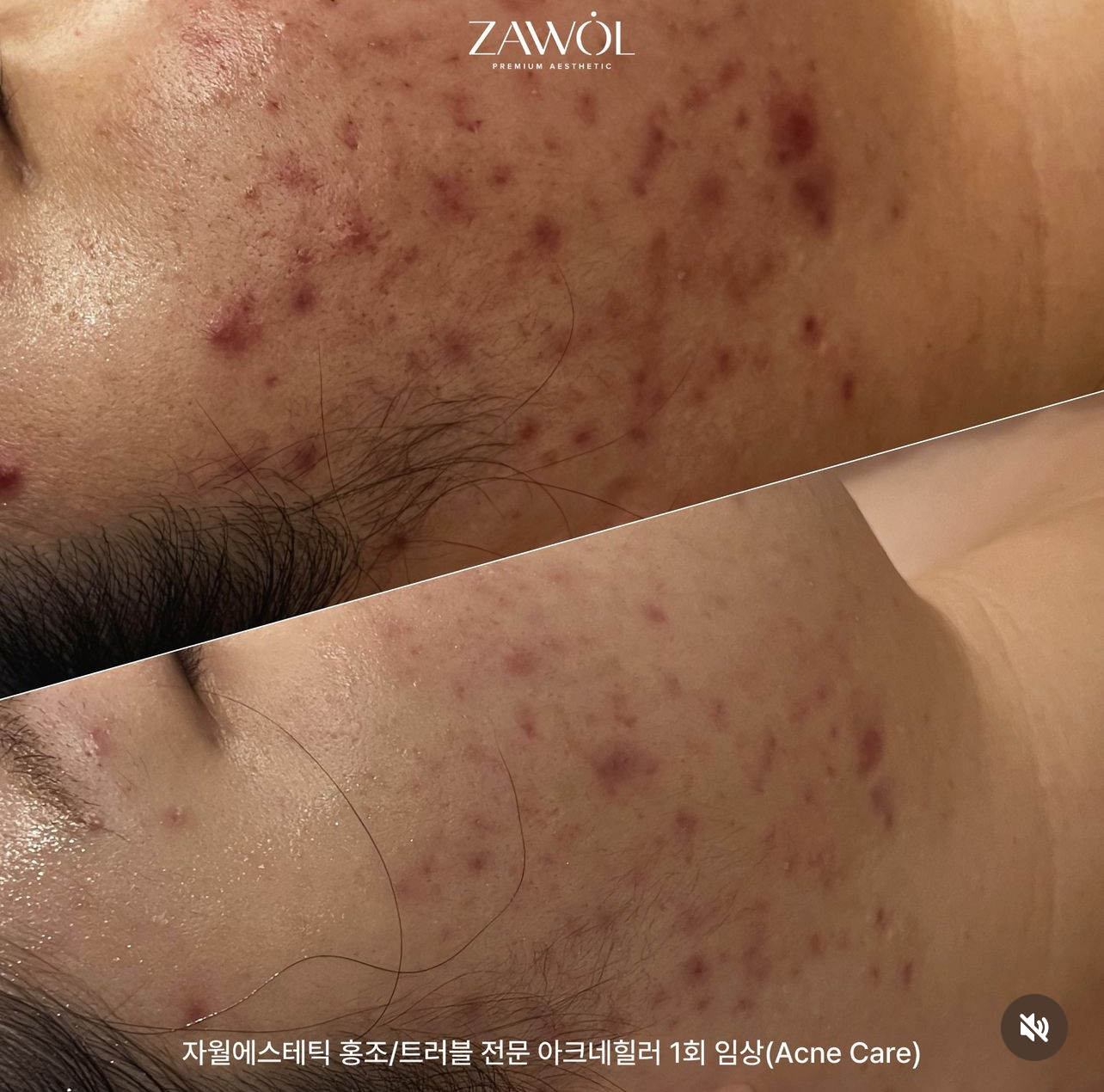 자월에스테틱 대표 이미지